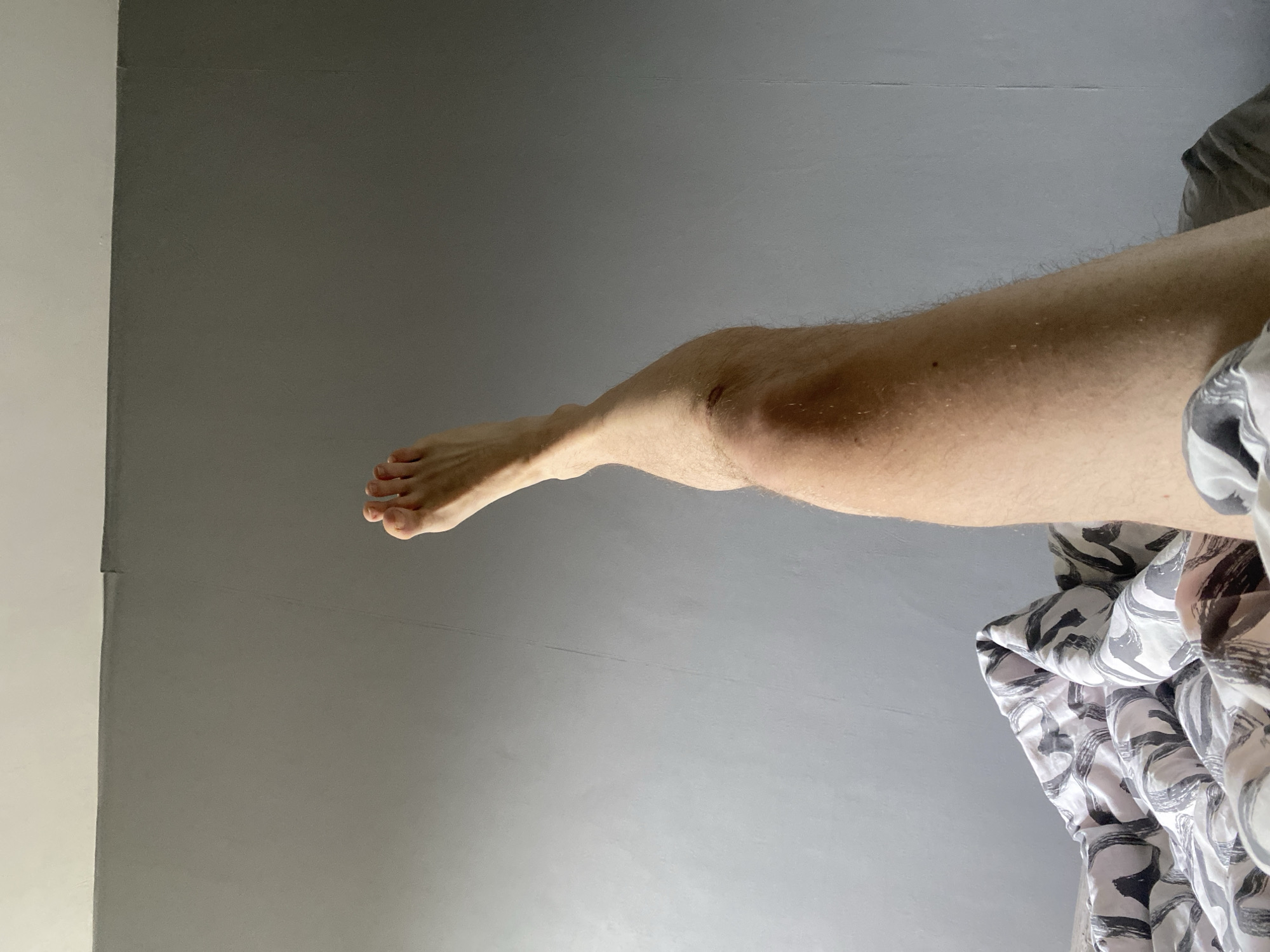 A person's left leg is partially visible, bent at the knee, with the foot extended upwards against a grey wall. The leg is covered in light hair and the skin is tanned. There is a slight abrasion on the knee. The lower part of the leg is obscured by a patterned duvet. The scene appears to be an indoor setting, possibly a bedroom, in Rusanovo, Russia.