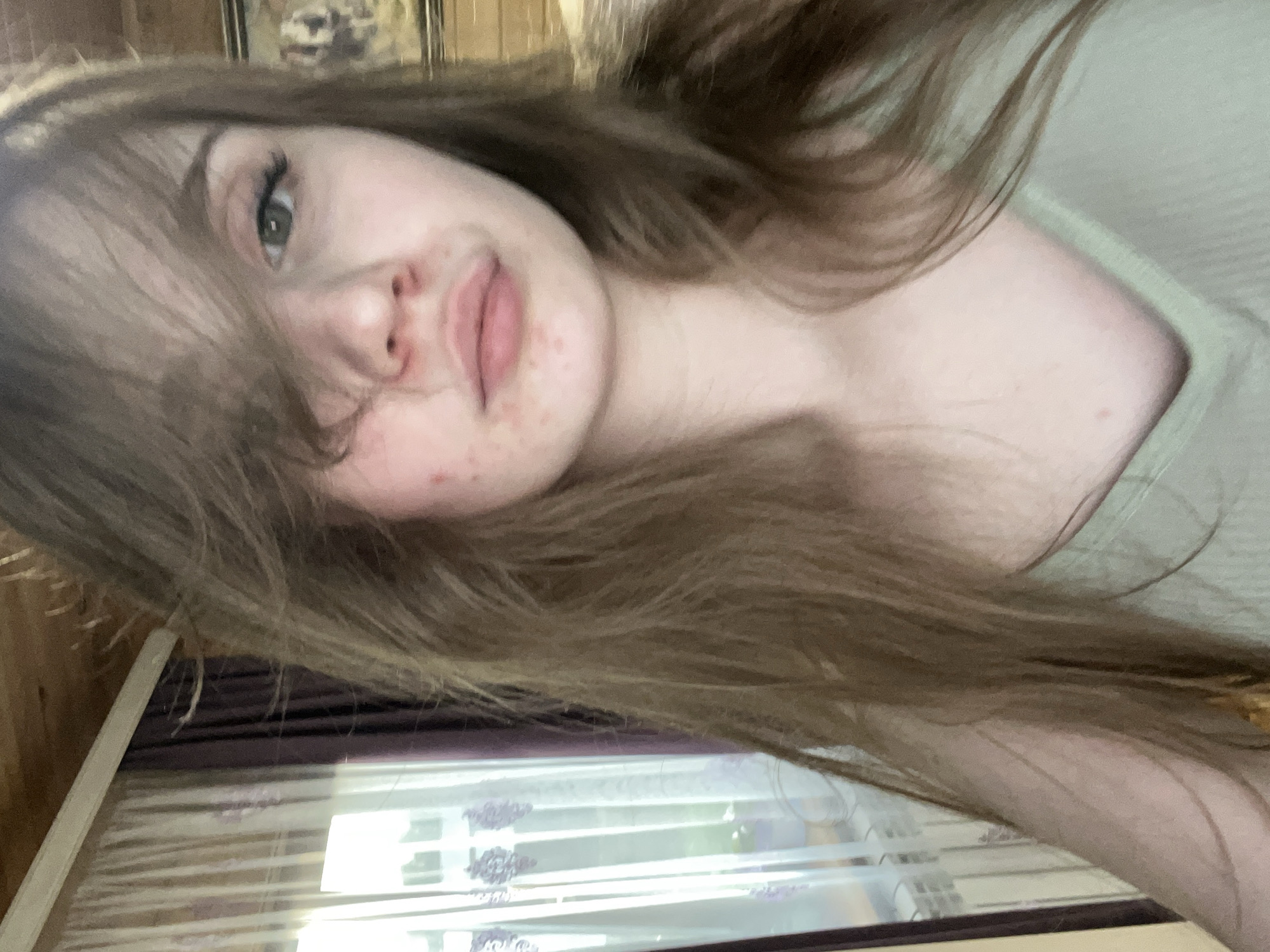 The image is a close-up, waist-up, selfie-style portrait of a young woman with light brown, wavy hair that partially covers her face. She has fair skin with visible redness and blemishes, particularly on her cheeks and around her nose and mouth. Her left eye, which is visible, is light green with dark eyelashes. She is wearing a light green, ribbed, v-neck top.
The background shows a window with sheer white curtains and dark purple drapes. The window appears to be covered with a white railing or trim. To the right of the woman, a portion of a framed artwork or picture is visible on a wooden paneled wall. The ceiling above is also made of wooden planks. The lighting suggests it is daytime, with sunlight coming through the window.
The photograph does not contain any discernible elements that would indicate the specific location within the city of Ashkadar, Russia.