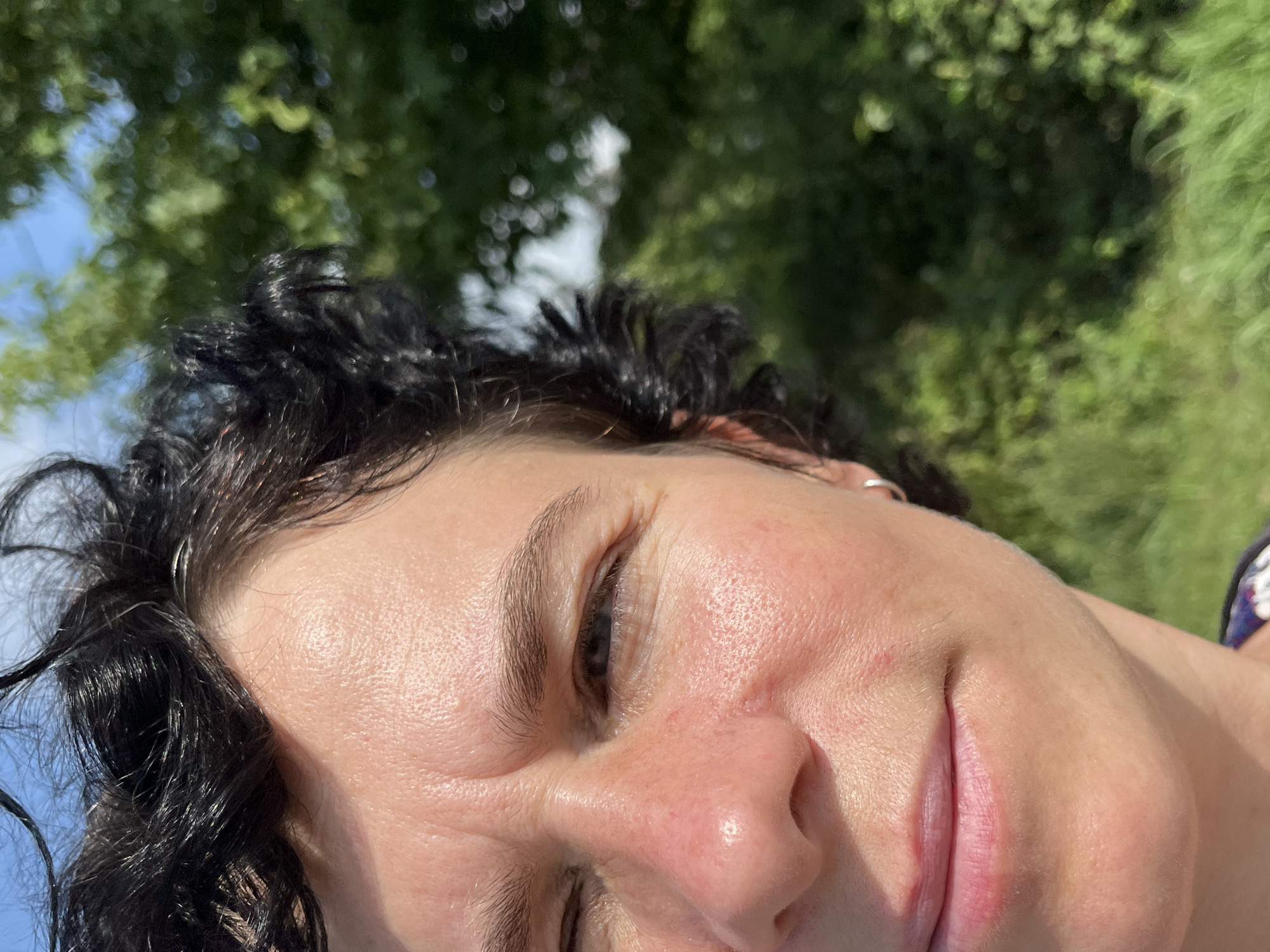 The image shows a close-up, half-face portrait of a person with dark, curly hair. The subject is outdoors, with a blurred green background of trees and foliage, suggesting a natural setting. The person's skin is fair and appears to have some texture and light redness on the cheeks and nose. They are looking towards the camera with one eye partially closed. Sunlight is visible, casting some highlights and shadows on the face. A small silver hoop earring is visible in the left ear. The person is wearing a dark garment with a colorful pattern visible at the bottom of the frame. The scene is consistent with being in the city of Ureki, Georgia, known for its coastal resorts and natural beauty.