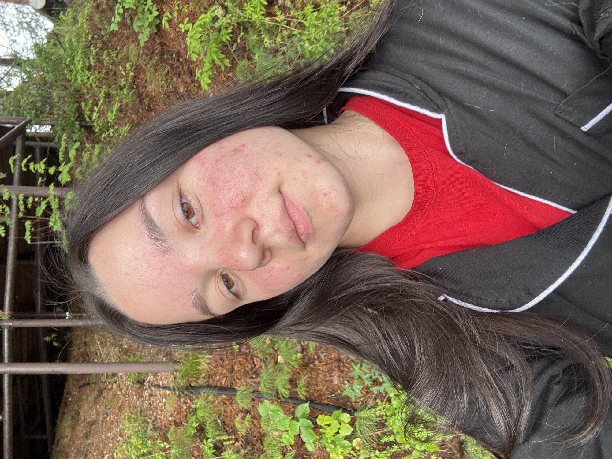 This is a vertical, eye-level, close-up selfie taken outdoors. The subject is a young person with long, dark brown hair, brown eyes, and fair skin. The person is wearing a red t-shirt and a black jacket with white trim. Their face is turned slightly to the left, and they are looking towards the camera with a neutral expression. There is visible acne on their cheeks and forehead, which are red and inflamed. The background is blurred but appears to be a natural outdoor setting with green foliage and brown ground cover, possibly dirt and pine needles. There are also some metal structures visible on the left side of the image, which could be part of a fence or railing. The lighting suggests it is daytime, possibly overcast or with soft, diffused light. There is no visible text in the image. The location context is Pozdyshki, Russia.