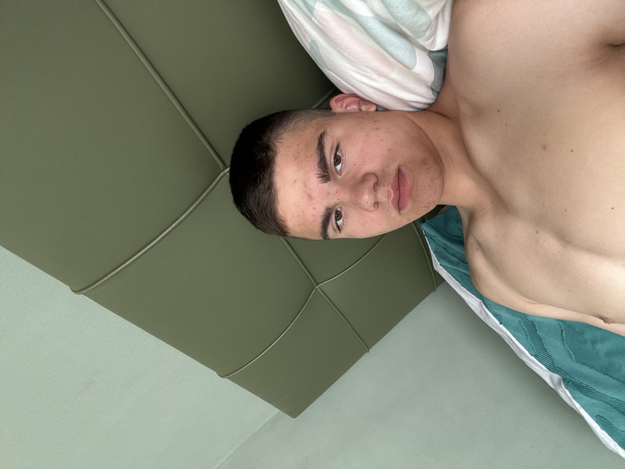 A young person with short, dark hair and light brown eyes is lying on their back, facing the camera. Their skin has some redness and blemishes, particularly on their forehead and cheeks. They are wearing a teal-colored shirt or blanket partially visible under their chin and chest. The background consists of a textured, olive-green surface, possibly a headboard or wall, with curved lines creating a geometric pattern. To the right, a pillow with a patterned cover in shades of white, light blue, and green is visible. The lighting appears to be natural, suggesting it might be daytime, and there are no clear indicators of the weather or specific location. The person's expression is neutral, with their gaze directed at the camera.