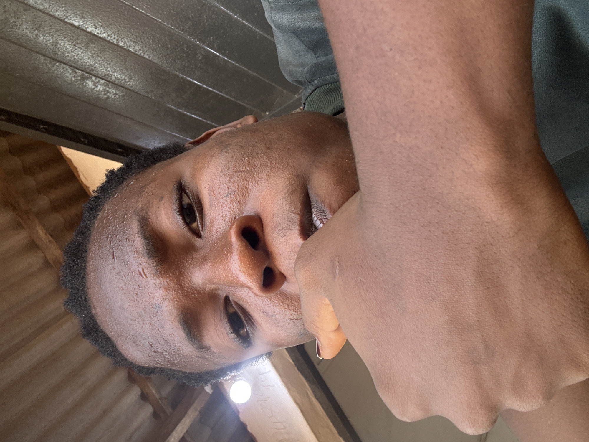 A close-up, low-angle photograph depicts a person with brown skin. Their face is damp and shows minor skin imperfections. They have dark eyes and hair. A hand, seemingly the subject's own, is positioned near their mouth.
The environment is ambiguous. The ceiling appears to be made of corrugated metal in one area and wooden boards in another. A light source is visible in the lower-left corner. The location is cited as Unknown, Unknown.