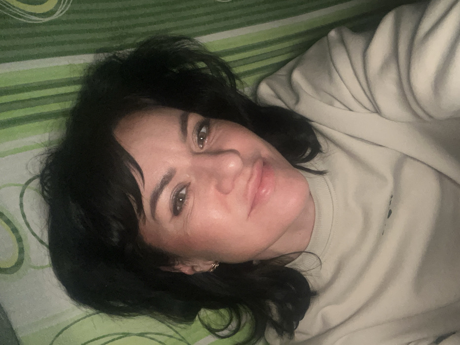 An indoor scene depicts an adult female lying supine, with her head inverted towards the bottom of the frame, looking directly at the camera. She has dark hair and brown eyes, and is wearing a light-colored (beige or light grey) crewneck sweatshirt. A visible swelling is present on her upper lip, superior to the philtrum, on the viewer's left side of her face. A small, golden-colored hoop earring is visible in her right ear. The individual is resting on a surface covered by a textile featuring a pattern of vertical stripes in various shades of green, with intermittent lighter, abstract circular or spiral designs. The specific location within Smederevska Palanka Municipality, Serbia, cannot be determined from the visual evidence in the image.