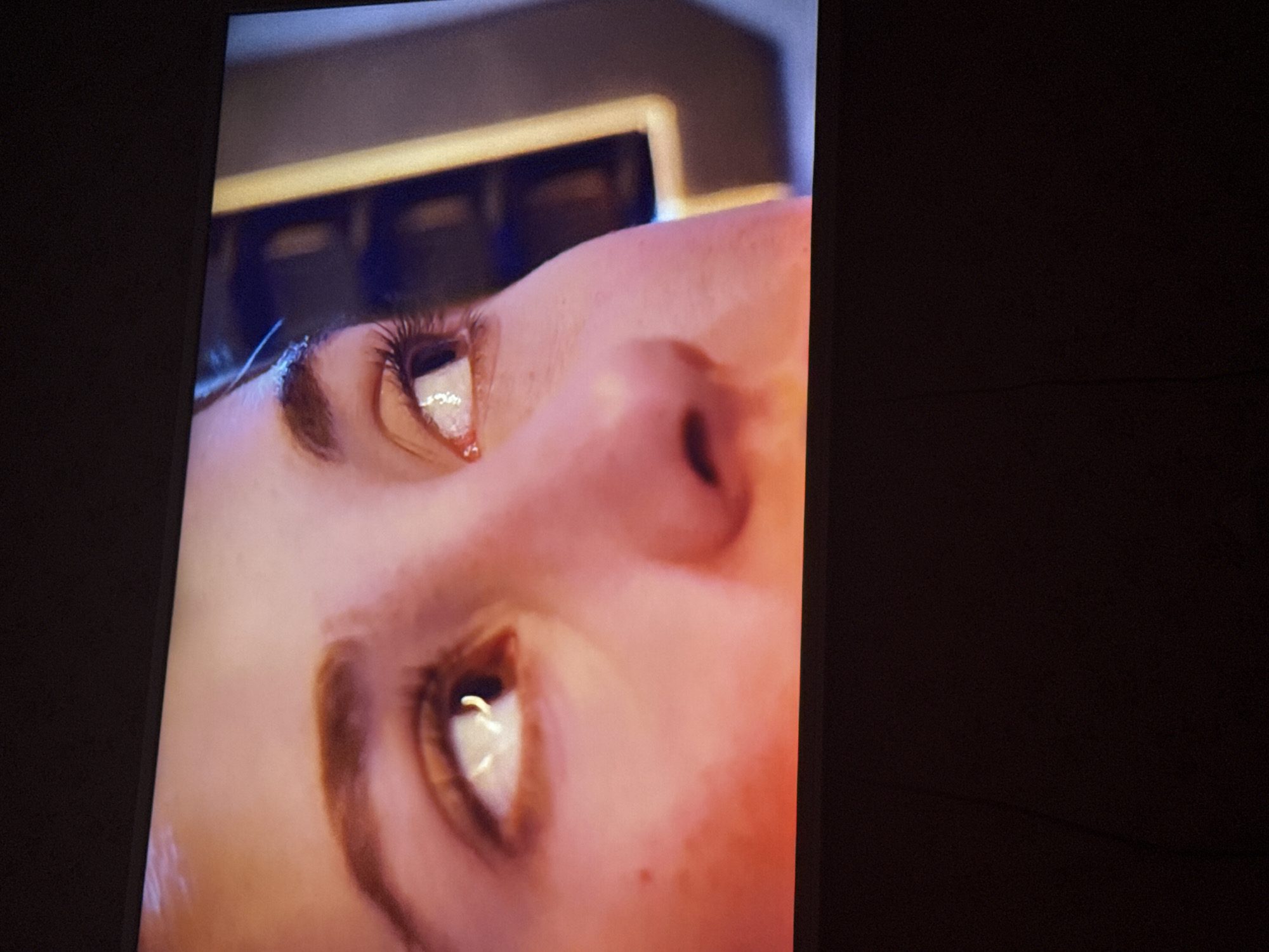 The image shows a close-up of a person's face, specifically the eyes and nose, viewed from a low angle. The person has eyelashes and eyebrows. The skin appears fair, with some visible pores and freckles. The lighting is reflected in the eyes. The background is blurry, revealing hints of an interior space. There is no clear indication of Mytishchi, Russia or any other specific location.