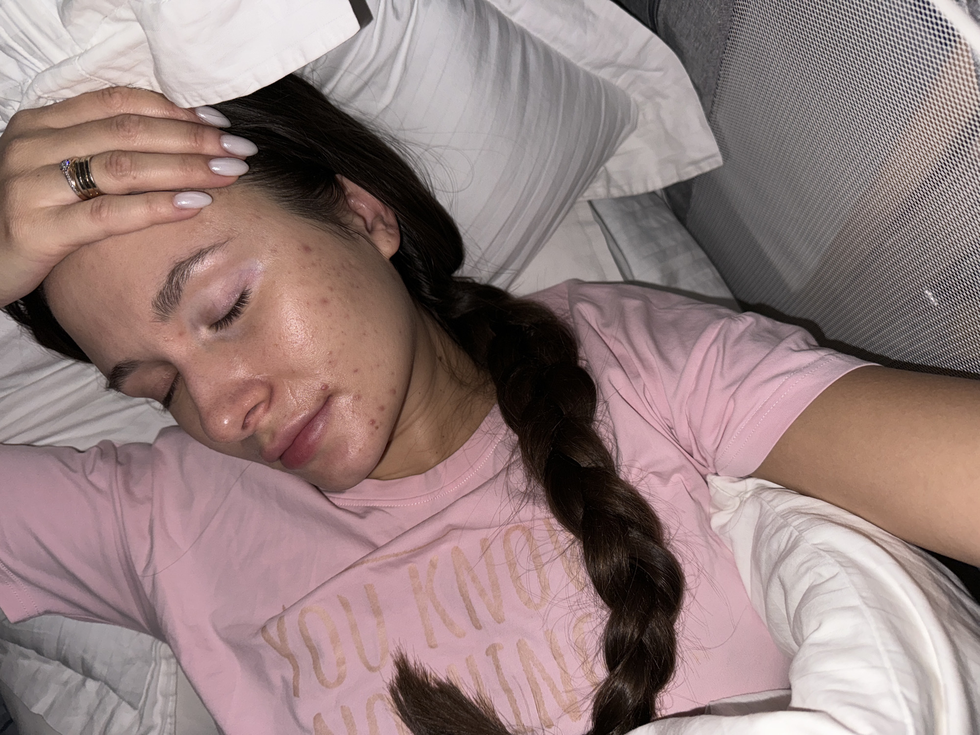 A close-up, dimly lit image shows a person, likely female, sleeping or resting in bed in Odintsovo, Russia. The person is lying on their left side, with their head resting on a white pillow, and eyes closed. Their right hand is placed gently on their forehead, displaying multiple rings on one finger, including a diamond-studded band. The fingernails are painted a light, neutral color.
The person has dark hair, which is styled in a long braid draped over their shoulder and chest. They are wearing a light pink short-sleeved t-shirt with faint, light-colored text partially visible on the front, appearing to start with "YOU KNOW." Their skin shows some blemishes, particularly on the forehead, cheek, and chin areas.
To the right of the bed, a mesh-sided structure, resembling a bassinet or crib, is partially visible, suggesting the presence of an infant nearby. The lighting is soft and subdued, indicating it might be nighttime or a darkened room. The overall impression is one of peaceful rest or sleep.