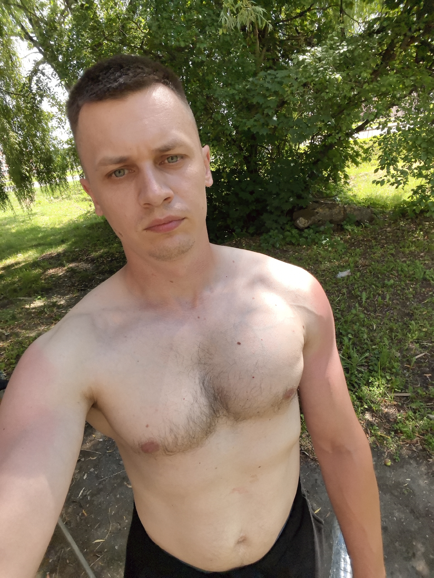 This is a selfie taken by a fair-skinned man with short brown hair and light green eyes. He is shirtless, wearing black shorts. He has a lean build with some chest hair and visible musculature. The right side of his upper body and arm show signs of sunburn, appearing redder than the rest of his skin. He has a neutral expression, looking directly at the camera.
The setting is outdoors, with lush green trees and foliage providing a backdrop. Sunlight filters through the leaves, creating dappled shade on the ground. The ground appears to be a mix of dirt and grass, with some fallen leaves and twigs scattered around. There is a large, fallen log visible in the background to the right. The overall impression is of a warm, sunny day in a natural, possibly wooded area. The lighting suggests it is daytime, likely late morning or afternoon. The man appears to be relaxing or enjoying an outdoor activity. No text is visible in the image.