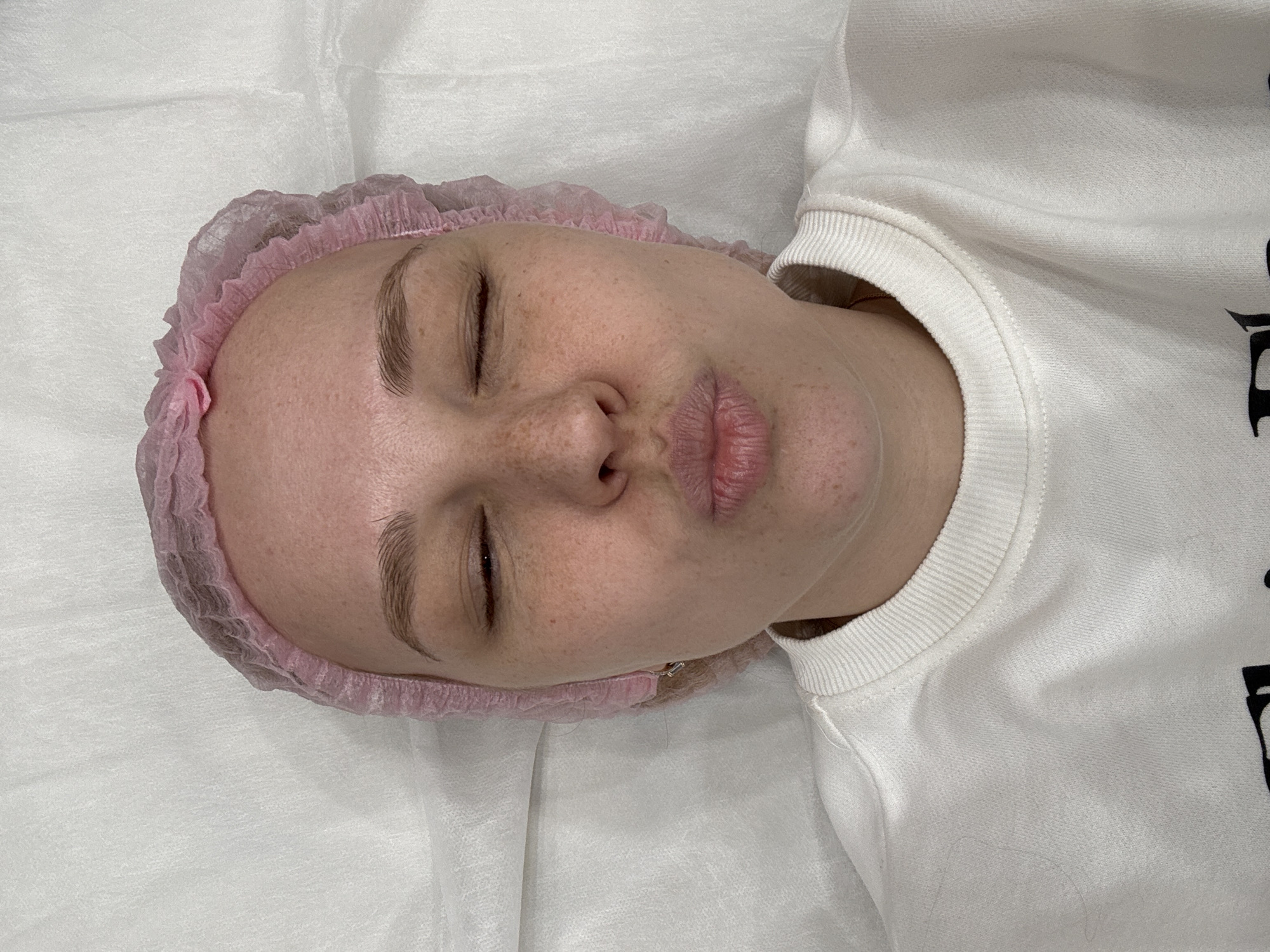 A woman with fair skin, freckles, and light brown eyebrows lies on a white surface, presumably a treatment table. She wears a pink disposable hairnet. Her eyes are closed and her lips are slightly puckered. She is wearing a white sweatshirt with what appears to be black lettering on the right side. The background is a plain white fabric, which could be a sheet or disposable cover. No landmarks indicating the location of Podosenikha, Russia are visible in the image.