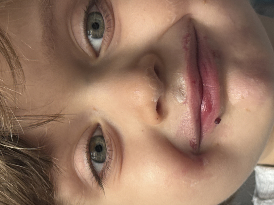 A close-up, head-on forensic image displays the face of a young child from the eyebrows to the chin, located in Khimki, Russia. The child has fair skin, light brown hair partially visible at the top of the frame, and light green/hazel eyes with dark pupils, staring directly forward. The lips and surrounding perioral area are stained with a dark red/purple substance consistent with berry residue. A distinct small, dark red, spherical object, resembling a berry, adheres to the skin just below the center of the lower lip. White, creamy residue is visible on the philtrum and around the nostrils. The child exhibits a slight smile with the corners of the mouth upturned. A blurred, neutral background is present, with a portion of light grey fabric, consistent with clothing, visible at the lower left.