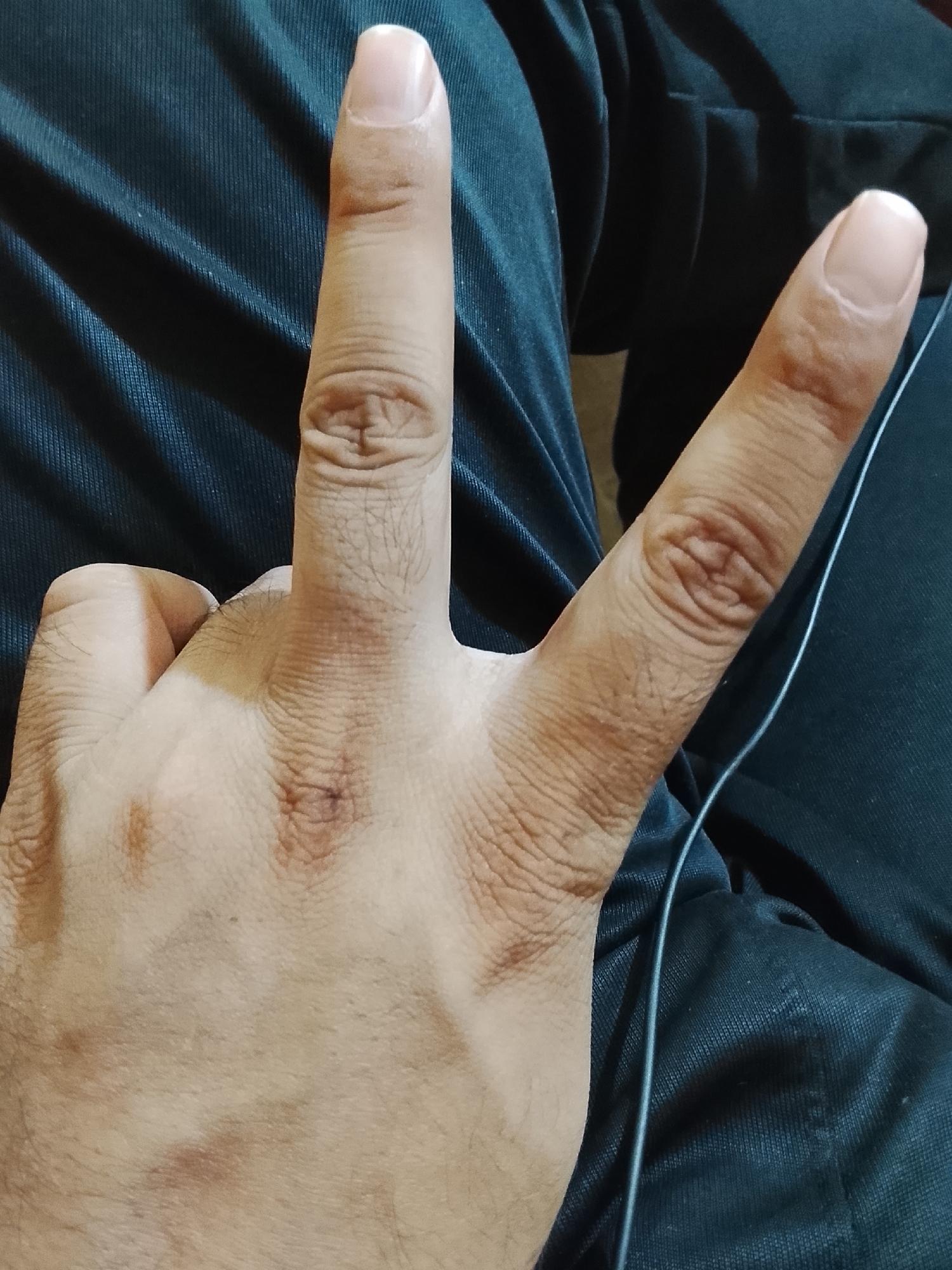 A right human hand is displayed against a backdrop of dark, textured fabric, likely clothing. The hand is positioned with the index and middle fingers extended upwards, while the other fingers are folded down. The skin of the hand is light brown, with visible wrinkles, veins, and small spots. A thin, light-colored wire or thread is also visible, running diagonally across the fabric near the hand. The location in Multan, Pakistan is not identifiable in the image.
