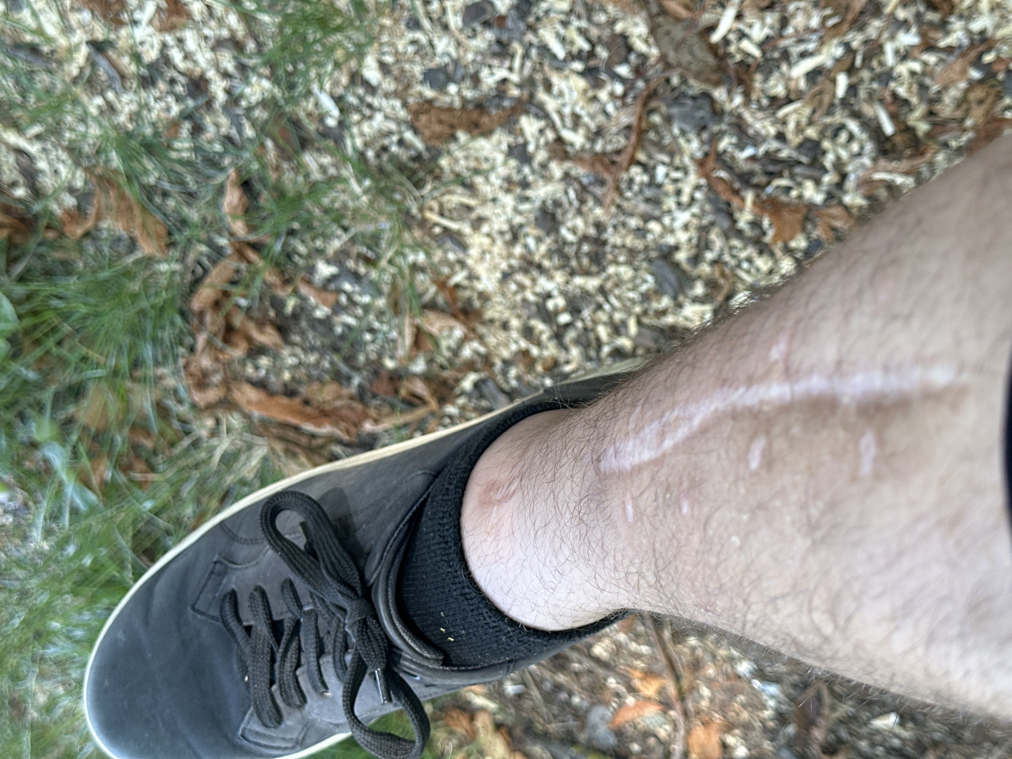 The image shows a close-up view of a person's lower leg and foot, wearing a black sneaker and black socks. The leg has a prominent scar running vertically down the shin. The background consists of dry grass, scattered leaves, and wood chips, suggesting an outdoor environment. The lighting is natural, and the focus is on the leg and shoe. There is no identifiable information about the location in Makiv, Ukraine, or any specific actions or interactions.