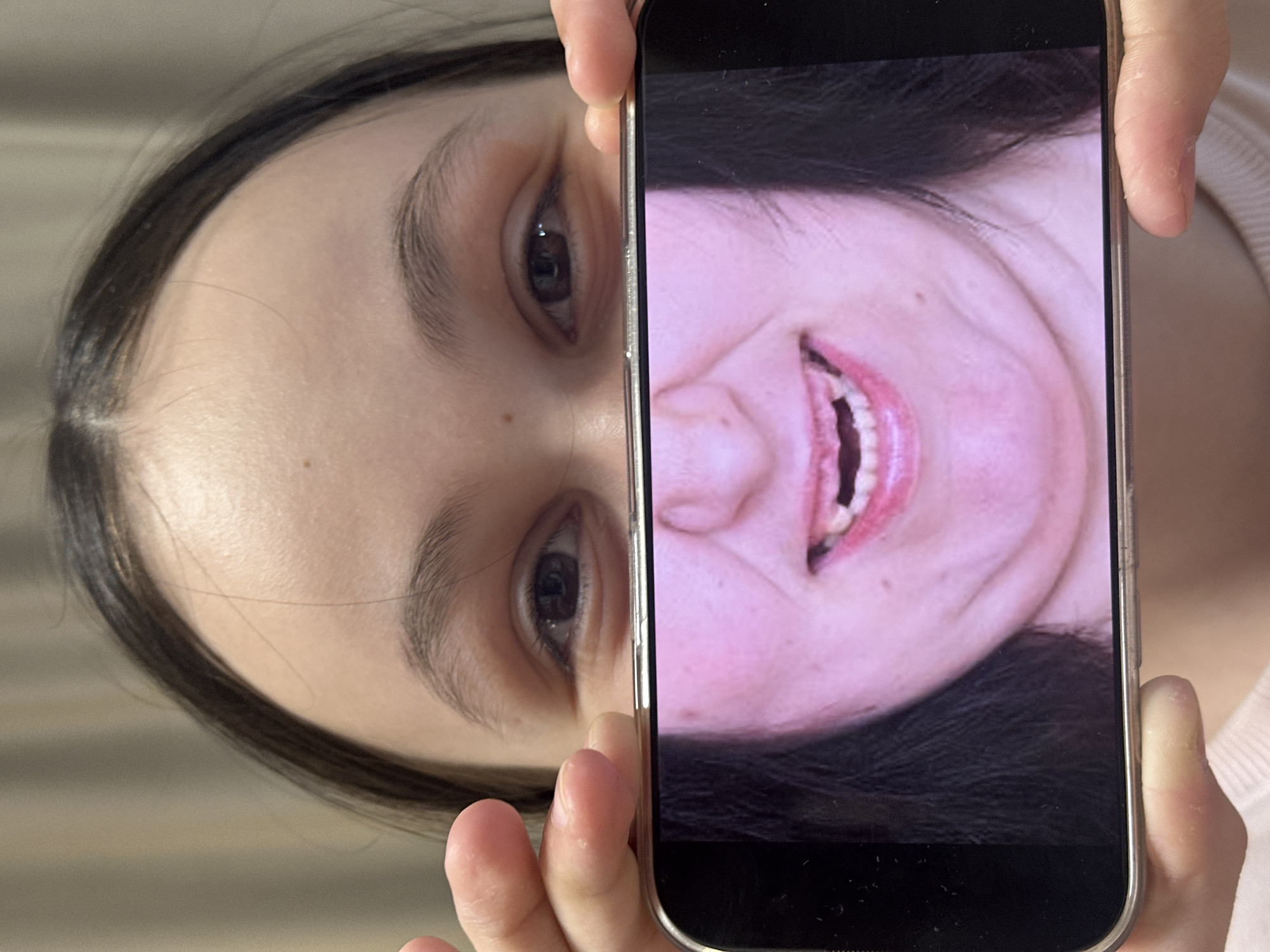 The image presents a close-up, tilted view of a person holding a silver-edged smartphone. On the left side of the frame, the left eye, eyebrow, and part of the forehead and cheek of the person holding the phone are visible. This individual has dark hair pulled back from the face and a neutral expression.
The smartphone screen, on the right side, displays a close-up, rotated portrait of another person's face. This person is shown in a broad, open-mouthed smile, revealing teeth. One tooth appears to be either missing or significantly discolored. The individual on the screen also has dark hair and fair skin, conveying an emotion of happiness or amusement.
The fingers of the person holding the phone are visible at the top and bottom edges of the device. The background behind the person holding the phone is soft, blurred, and light-toned, suggesting an indoor setting. There are no specific distinguishing location cues, time of day, or weather indicators present. No text is visible on the phone screen or in the background.
