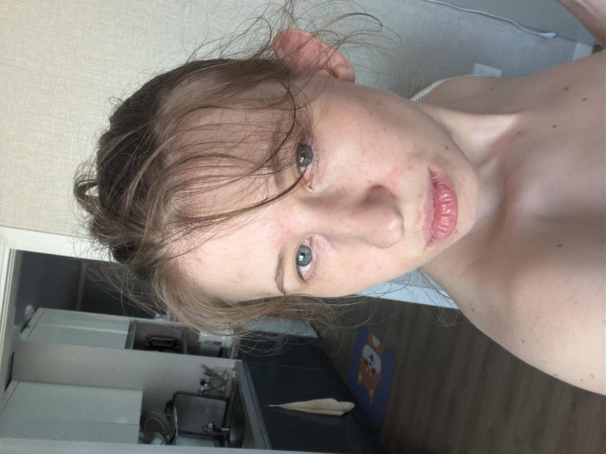 A young Caucasian woman with light skin and light brown hair pulled back into a messy bun is shown in a close-up, selfie-style portrait. Her eyes are blue, and she has visible freckles and some redness around her eyes and on her cheeks, possibly indicating irritation or a skin condition. Her lips are slightly parted. Her right ear is prominently visible. She is not wearing any visible clothing on her upper body, revealing moles on her shoulder and décolletage.
The background suggests an indoor domestic setting, likely a kitchen area. Cabinets are visible, along with what appears to be a sink and countertop. A kitchen towel hangs on a cabinet door, and a small, blue mat with a cartoon dog design is on the floor. The lighting is natural and appears to be coming from the right side of the frame. The overall environment is somewhat cluttered, suggesting a lived-in space. The image quality is good, with clear details of the subject's features. The photograph was taken at a residence in Dongducheon-si, South Korea.
