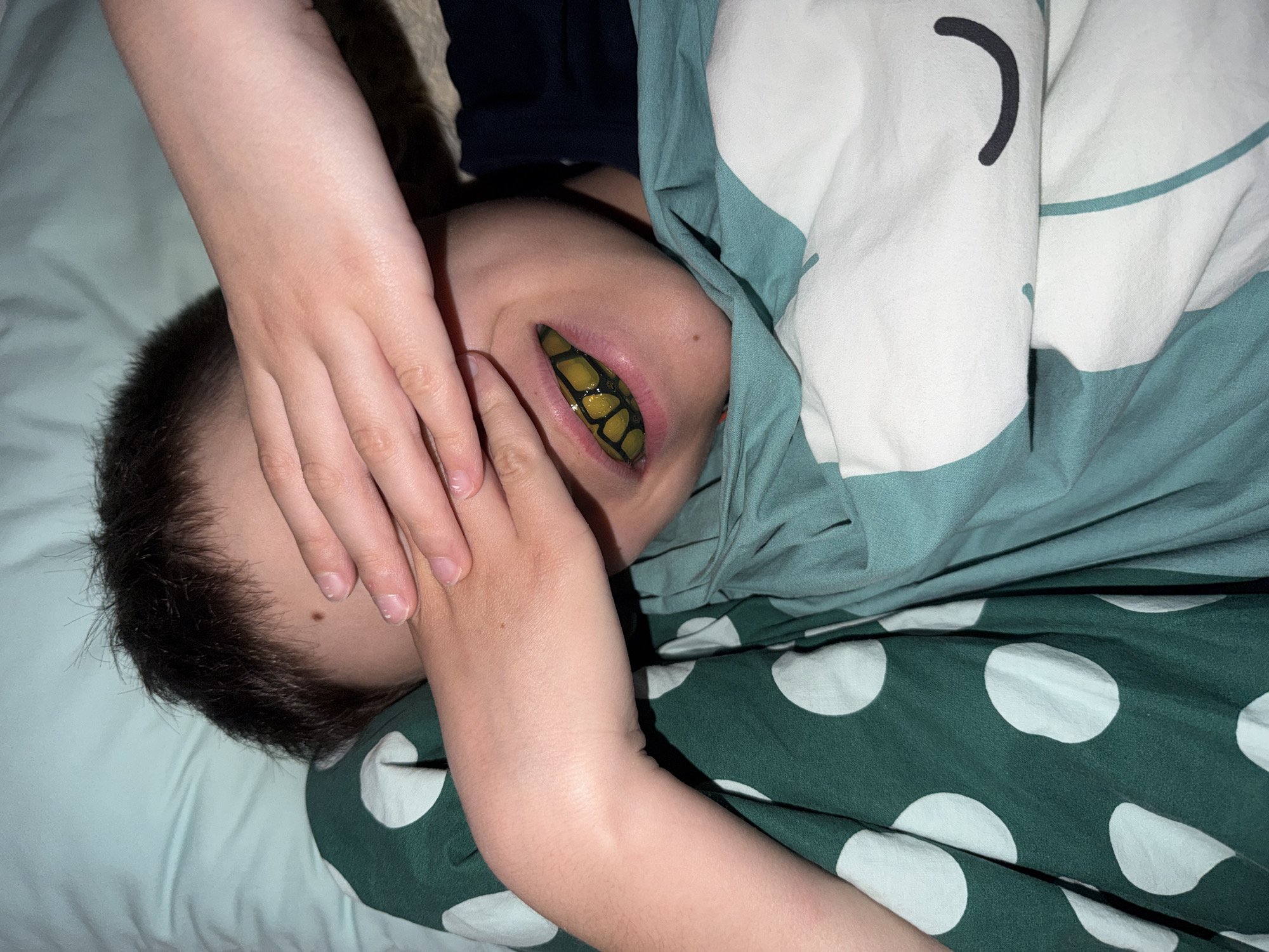 A child lies in a bed covered with a green and white polka-dot patterned sheet and a white and turquoise comforter with cartoon face designs. The child's face is partially obscured by their hand, and a yellow and black reptile's tongue is protruding from their mouth. The location is not identifiable as being Votkinsk, Russia, based on the provided image.