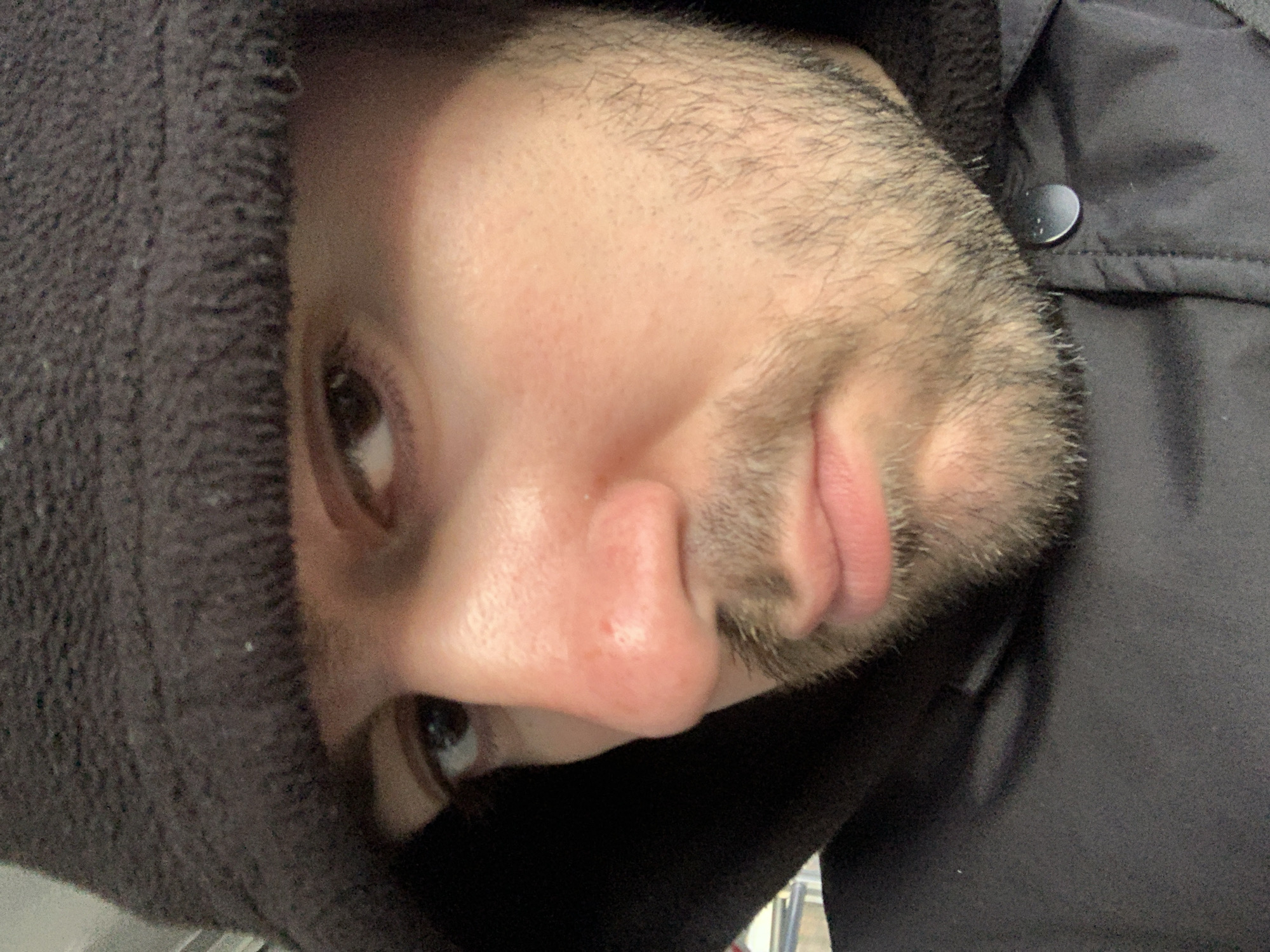 The close-up, angled shot features a person, likely male, looking directly into the camera. The individual has light to medium skin tone and a dark, short beard or stubble covering the cheeks, chin, and upper lip. Their dark eyes are visible, and there is a noticeable reddish spot or blemish on the bridge of their nose. The person is wearing a dark, possibly black or dark grey, hooded garment with a textured, fleece-like material. Small white specks are visible on this fabric. Over or beside the hooded garment, another dark, smooth-textured garment, possibly a jacket, is seen, featuring a prominent black snap button. The lighting suggests an indoor setting or a dimly lit area. The overall composition is a direct, intimate portrait, possibly a selfie, taken at an unusual angle. There is no visible text in the image. Given the context, the photo was taken in Chaikovsky, Russia.
