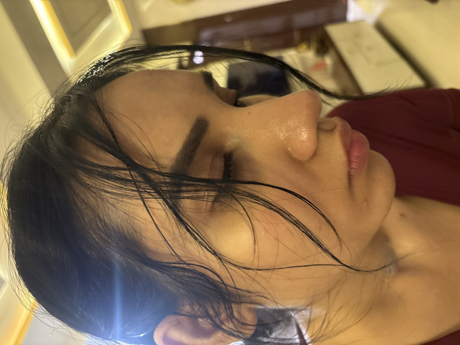 A close-up, right-profile view captures an adult female indoors in Howrah, India. Her eyes are closed or directed downwards. Dark hair, appearing wet and styled to the back, has loose, wet strands clinging to her forehead, temple, and right cheek. Her skin exhibits a reflective sheen, and several small, pale, raised blemishes are visible on her forehead, the side of her nose, and her chin. She wears a maroon-colored garment, visible around her neck and shoulder. The background is out of focus, showing warm-toned artificial lighting fixtures on a ceiling and indistinct, blurred interior elements.