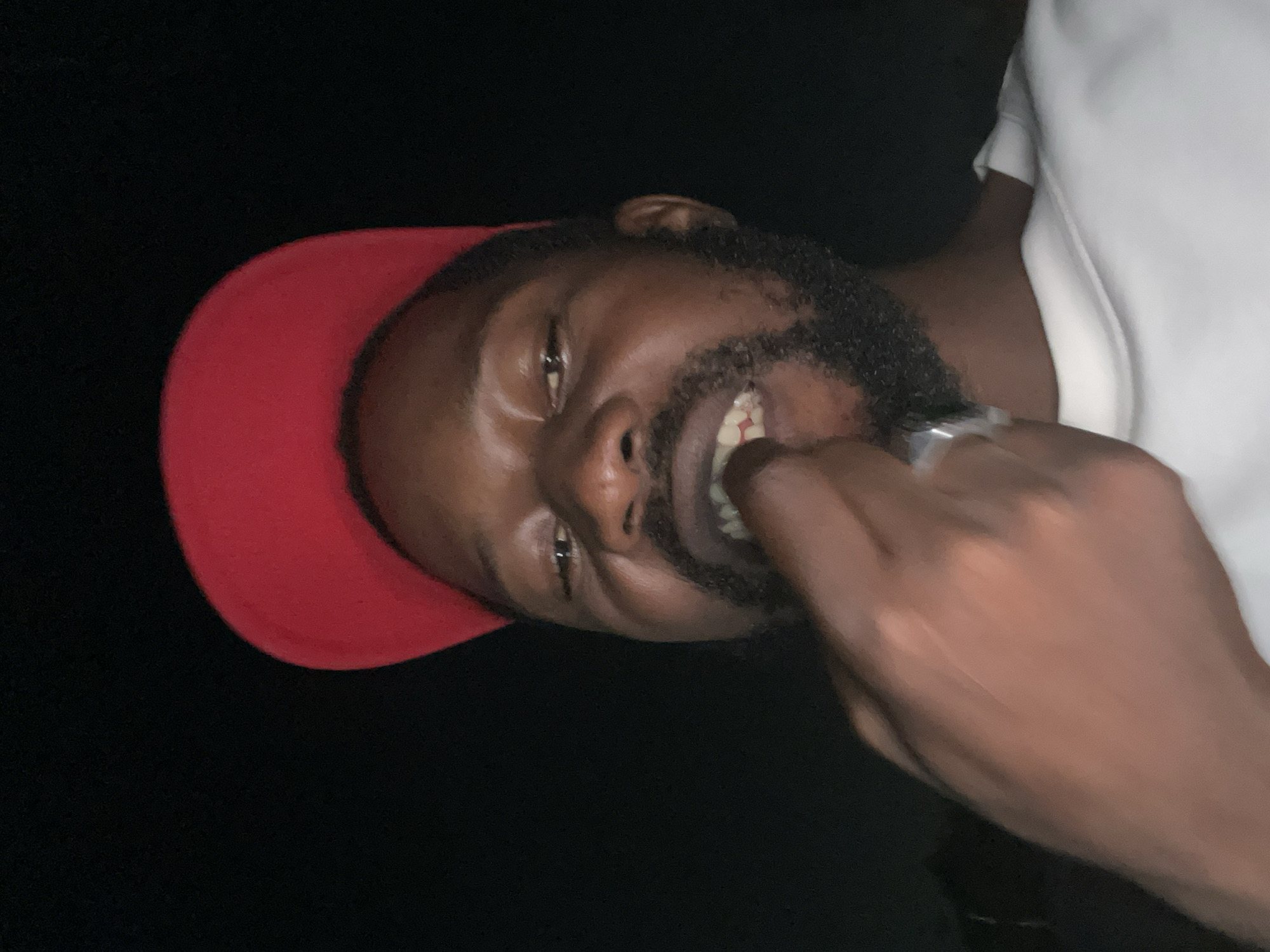 A medium-shot image depicts a Black man with a dark beard and a red baseball cap. He is wearing a white t-shirt and a silver ring on his finger. His right hand is raised towards his mouth, with his fingers slightly inside. The background is dark, and there is no evidence indicating Galadimawa, Nigeria.