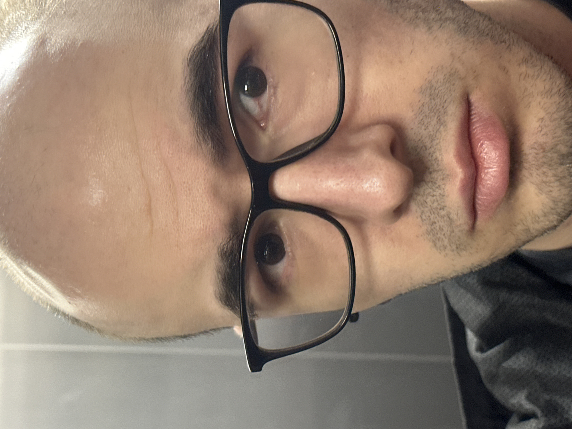A close-up, rotated image of a person's face, likely male, wearing black-rimmed glasses. The person has light skin, dark eyebrows, dark eyes, and stubble on their face. The background appears to be a gray wall or surface. The city of Khimki, Russia, is not detectable in the image.