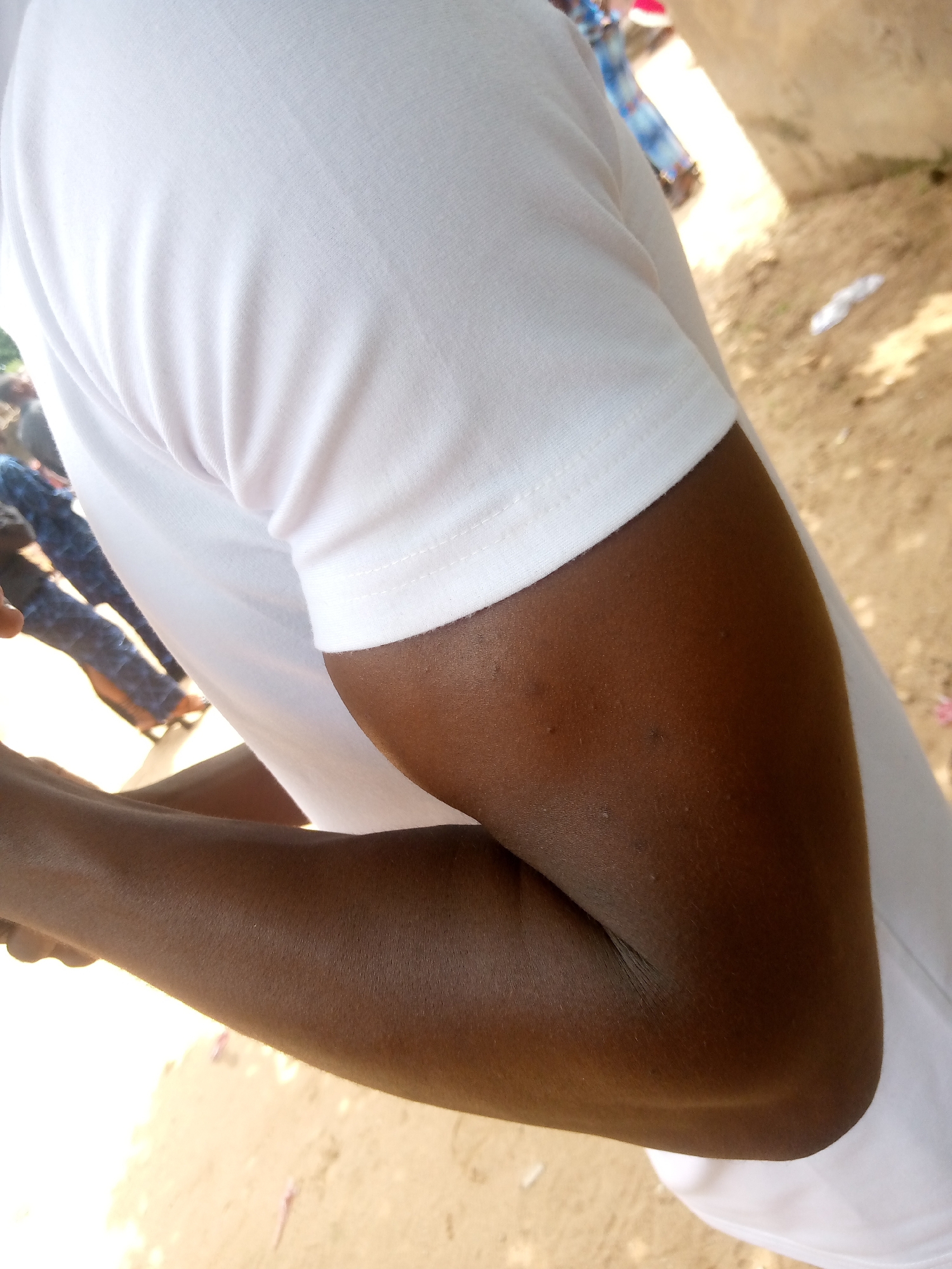 The image captures a close-up view of a person's arm and shoulder, predominantly clad in a white t-shirt. The skin tone of the arm is dark brown, and there are a few small blemishes visible on the upper arm. The t-shirt is plain white with a visible stitched hemline on the sleeve. In the background, out of focus, there are hints of other people wearing colorful clothing, suggesting a gathering or an outdoor event. The ground appears to be dirt or sand, with some scattered debris. The overall lighting suggests an outdoor setting, likely during the daytime. While the specific location within Jalingo, Nigeria, cannot be precisely determined from the visual information alone, the context of outdoor activity and the skin tone of the individual are consistent with the demographics of the region.