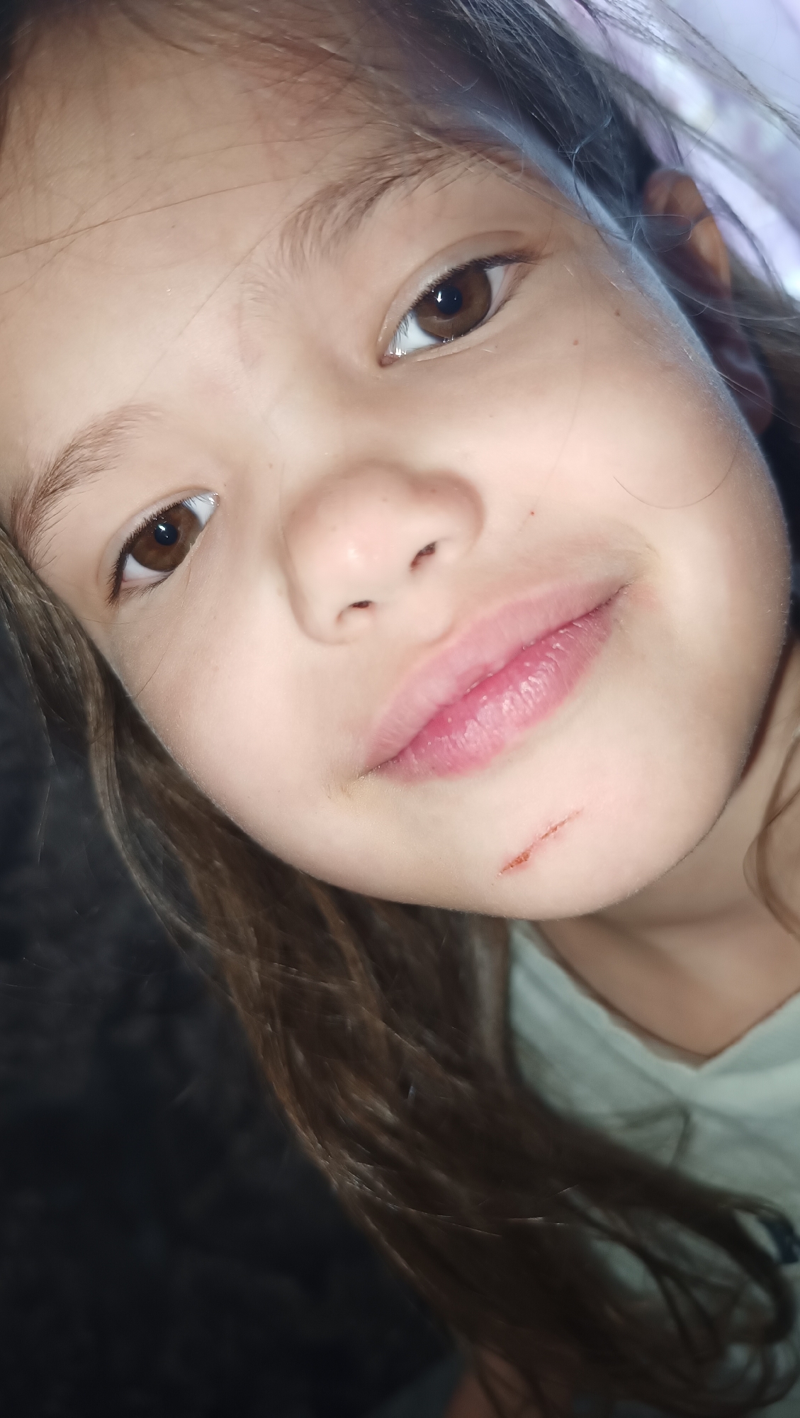 A close-up, upward-angle shot shows the face of a young girl. She has light brown eyes, fair skin, and dark brown hair that is parted on her right. Her lips are slightly parted, revealing a slight smile. There is a small, reddish-brown scratch on her chin, just below her lower lip. The background is dark and out of focus, with hints of purple light. The image is likely a selfie taken indoors. The information about Karsha, Russia is not visible in the image.