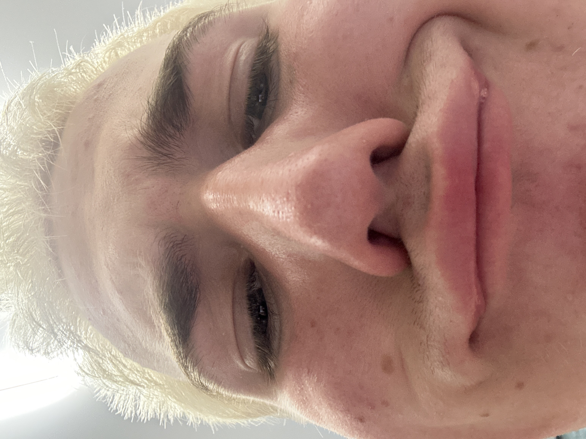 The media file features an extreme, close-up portrait of a person's face, tilted significantly and viewed from a low angle, almost appearing upside down. The subject has fair skin, dark, well-defined eyebrows, and bright, light blonde hair that appears almost white against an overexposed, stark white background.
The image focuses intensely on the central facial features. The eyes are partially closed or looking downwards, with long, dark eyelashes and pupils subtly visible. The nose is prominent, occupying a significant portion of the frame, showing its bridge and nostrils. The mouth is slightly open, revealing the philtrum and a portion of the upper lip.
Notable details include the texture of the skin, which shows visible pores, small bumps, and scattered freckles or moles, particularly on the cheeks and forehead. The blonde hair appears fine and light, framing the forehead and temples. The lighting is very bright, creating an almost halo effect around the hair and highlighting the contours of the face, while also leading to an underexposed, featureless white background. The unusual angle suggests a selfie taken from a low perspective. No visible text is present. Due to the extreme close-up and angle, it is difficult to discern a specific emotion or activity, beyond the act of posing for the photograph.