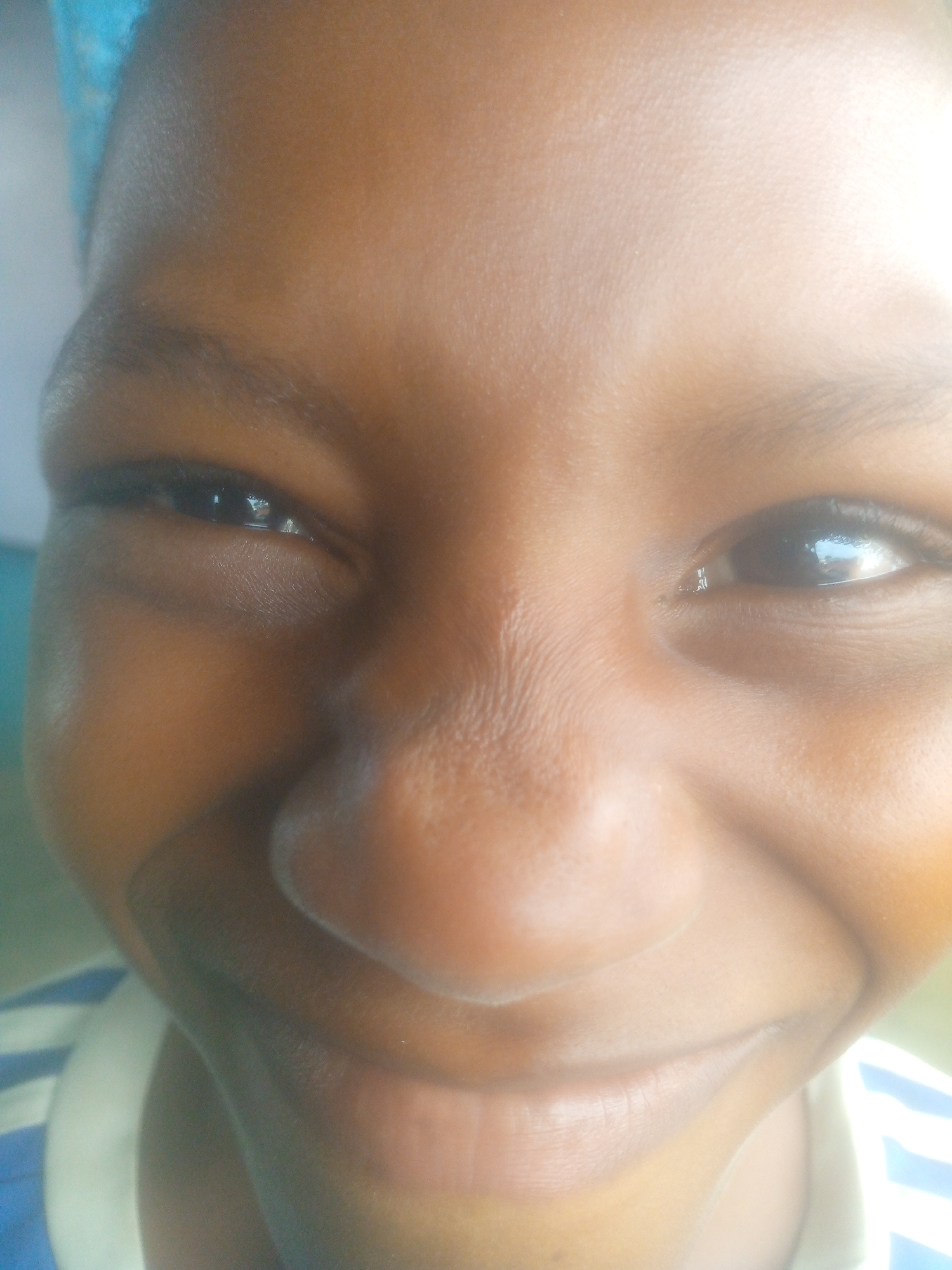 A close-up photograph shows the face of a child with dark skin, focused primarily on the nose, eyes, and mouth. The child is smiling. A blue cloth is visible in the upper left corner of the frame. The child wears a shirt with blue and white stripes near the bottom. The location is Unknown, Unknown.