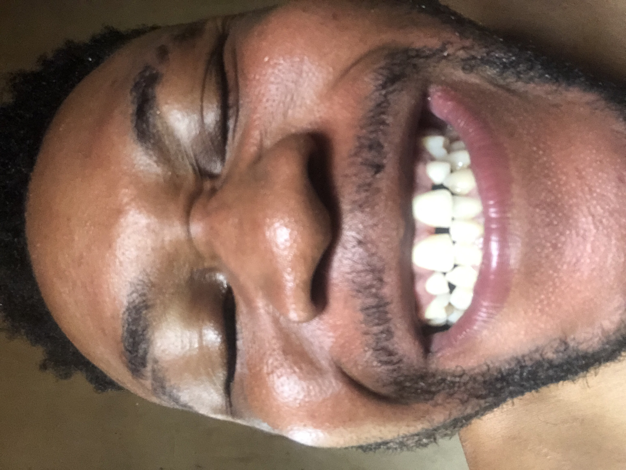 A close-up, rotated image shows a dark-skinned person with closed eyes and an open mouth revealing their teeth. The person has curly dark hair and a beard. The skin appears moist or oily. The location is unknown.