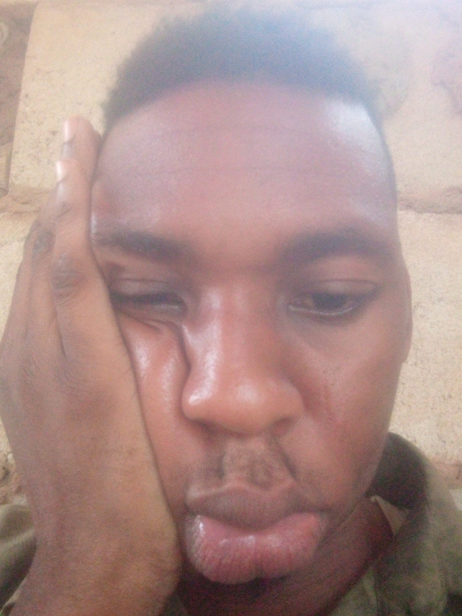 A close-up shot depicts a Black male with dark, short hair and facial features, including a prominent nose and full lips. His skin appears oily or sweaty. He has a weary expression with his left eye partially closed and his right eye looking down. His left hand is against his face, with his fingers spread. The background is a blurry, light-colored wall. The location is uncertain and cannot be determined from the image.