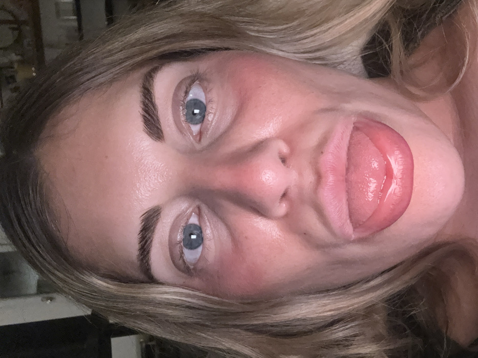 A close-up, eye-level photograph captures a Caucasian adult female. She has long blonde hair visible on both sides of her face, blue eyes, and dark, well-defined eyebrows. Her face presents with a flushed or reddened appearance, particularly across the cheeks and nose, and some redness is also evident around her eyes. Her mouth is open, with her tongue extended forward and slightly downwards, appearing moist. She is looking directly at the camera. The background is dark and significantly out of focus, indicating an indoor setting with limited ambient light. Indistinct, blurred shapes, possibly furniture or decorative items, are faintly visible in the upper right portion of the background. This scene is located in the city of Rueil-Malmaison, France.