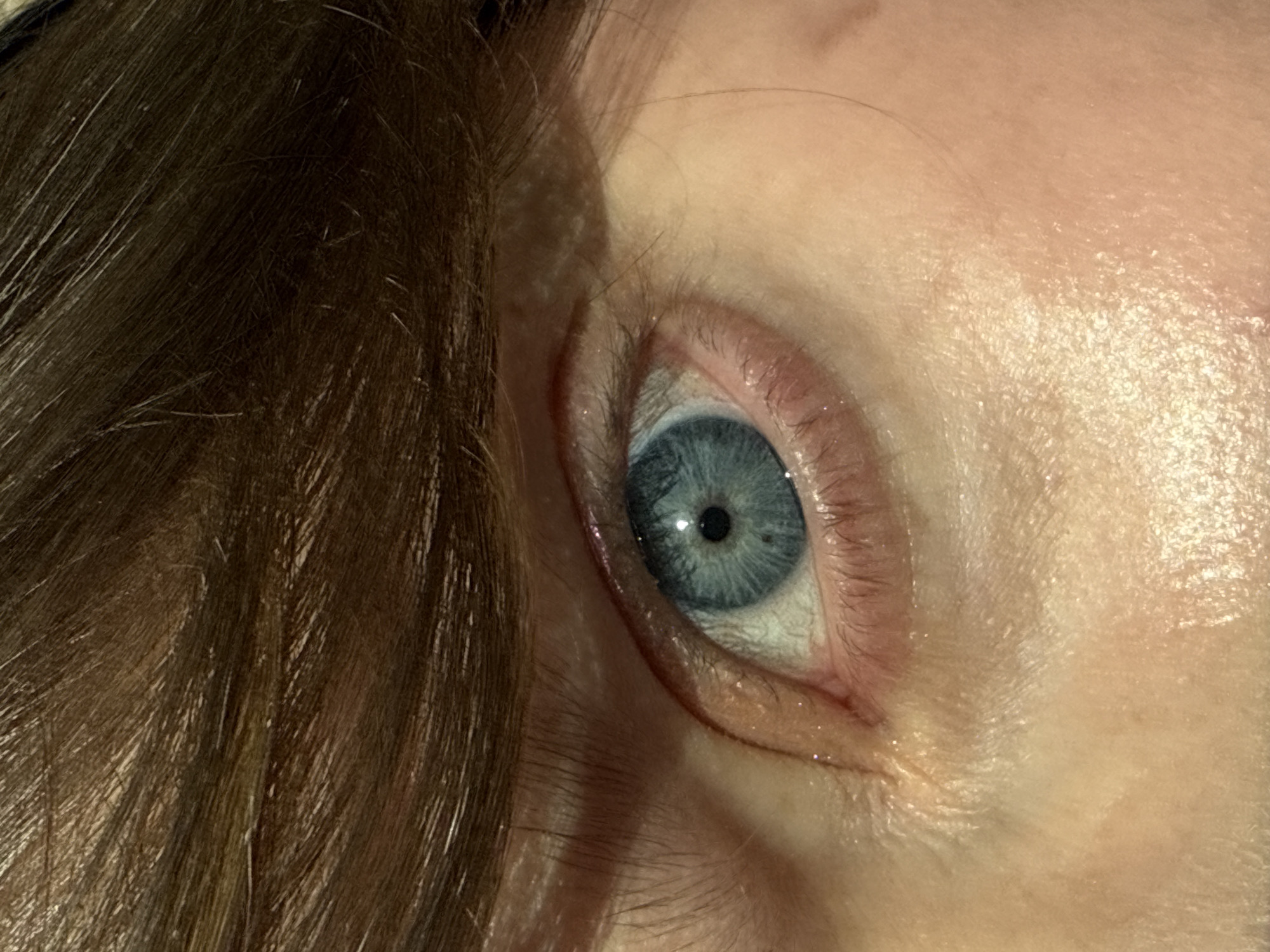 An extreme close-up photograph shows a person's blue eye and the surrounding skin and hair. The eye is centrally positioned, with the iris a textured blue and a black pupil. The skin around the eye appears fair, with visible fine wrinkles and the beginning of a tear duct. Eyelashes are sparse and light-colored. Brown hair is visible on the left side of the image. The skin appears shiny, possibly due to moisture or lighting. There are no indications or details connecting the image to the city of Izhevsk, Russia.