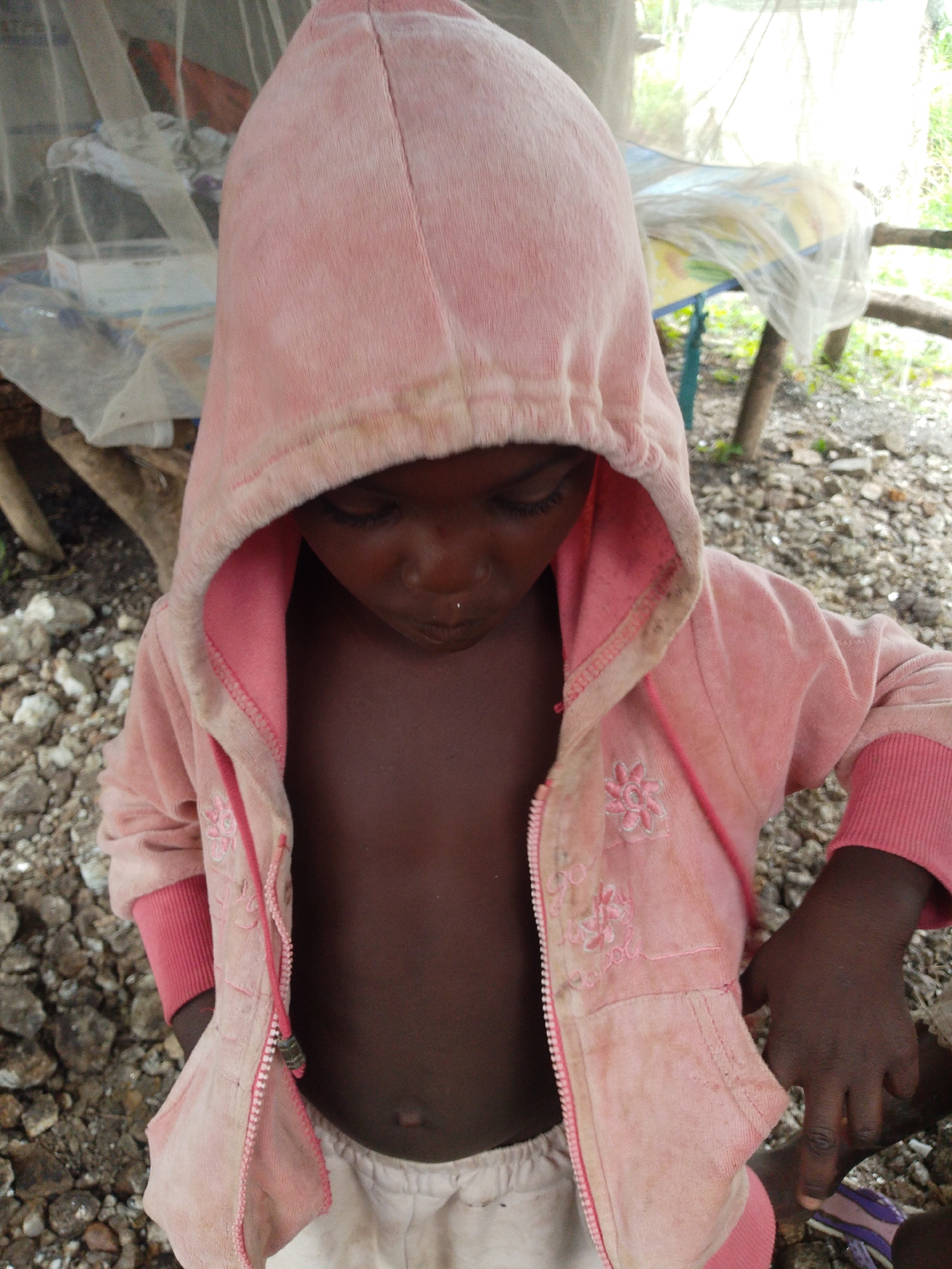 A young Black child, wearing a pink hooded jacket, looks down. The child is wearing light-colored shorts. The child is outdoors, on the ground covered with stones and debris, possibly in Otulu, Nigeria. A table covered with a plastic sheet is visible in the background, supported by wooden poles. The scene is lit by natural daylight.