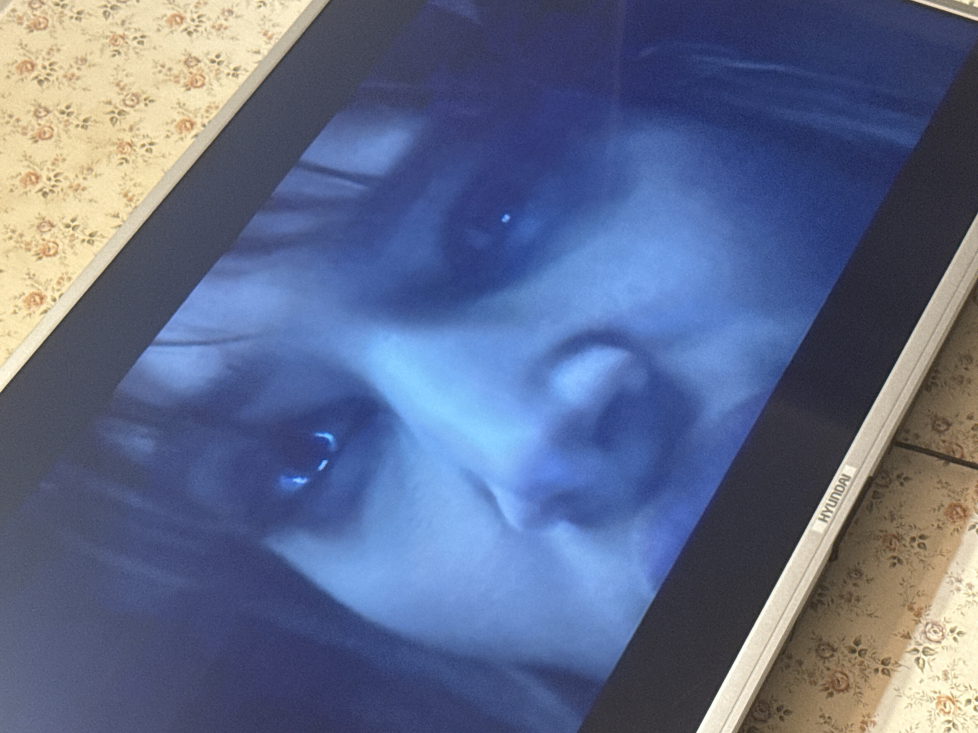 The image shows a close-up of a Hyundai monitor displaying a face. The monitor is placed on a surface with a floral pattern. The brand "HYUNDAI" is visible on the lower right side of the monitor's frame. The face on the screen is in shades of blue. No information regarding the location in the city of Mytishchi, Russia is available.