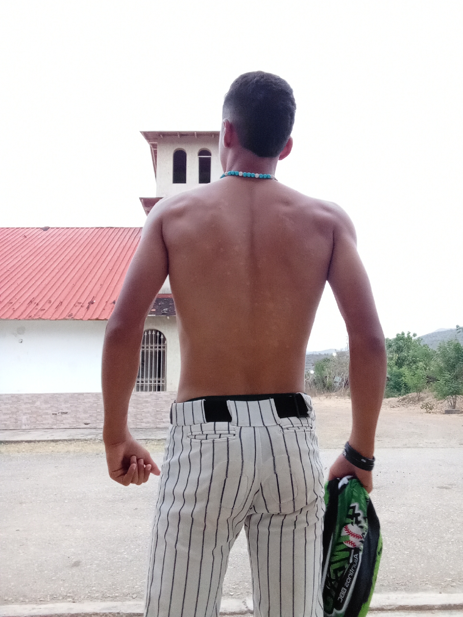 This image captures a young man from behind, standing outdoors under a bright, overcast or intensely lit sky, possibly midday. He is shirtless, revealing his back and arms, which show some lighter, irregular patches on the skin, potentially indicating sun exposure or a dermatological condition. Around his neck, he wears a turquoise beaded necklace.
He is dressed in light-colored pants with thin black vertical stripes, characteristic of baseball attire, held up by a black belt. In his right hand, he holds a green and black baseball cap or glove, which displays a baseball graphic and partially visible text including "BAL," "CONTINUA," and "BBC." A dark wristband or watch is visible on his left wrist.
The background on the left features a distinct building with a white or light-colored facade and a reddish-orange tiled roof. A tower-like section of the building has multiple arched windows at the top, and a lower window is covered by a metal grate. To the right, the landscape transitions to a dusty, arid terrain with sparse green trees and shrubs, and subtle hills in the distance. The ground beneath the man appears to be a paved or dirt road. The scene's architecture and arid vegetation are consistent with the location context of Juan Griego, Venezuela, suggesting a warm and sunny climate.