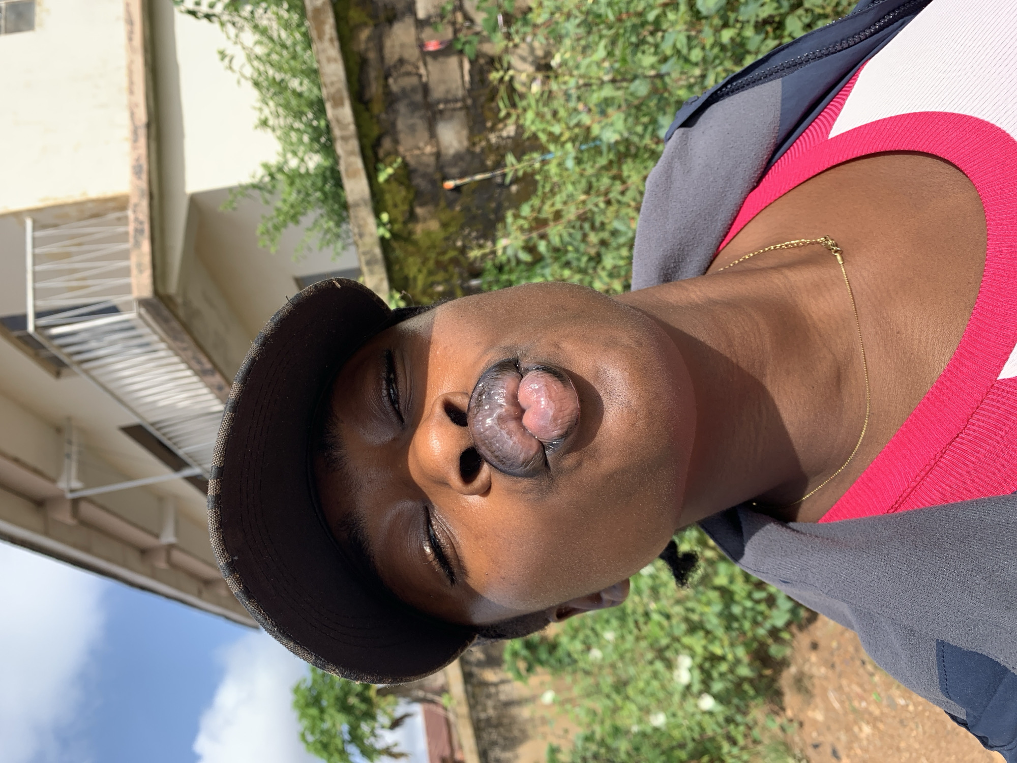 A close-up, eye-level, outdoor, selfie-style shot shows a young Black person wearing a dark baseball cap, a grey jacket over a bright pink shirt, and a thin gold chain. The subject is looking directly into the camera with their lips puckered in a kiss. Sunlight illuminates their face, highlighting their eyes, nose, and lips. In the background, a light-colored, two-story building with a balcony and railings is visible. Green bushes and a moss-covered stone wall are also present. The overall setting appears to be a residential area.