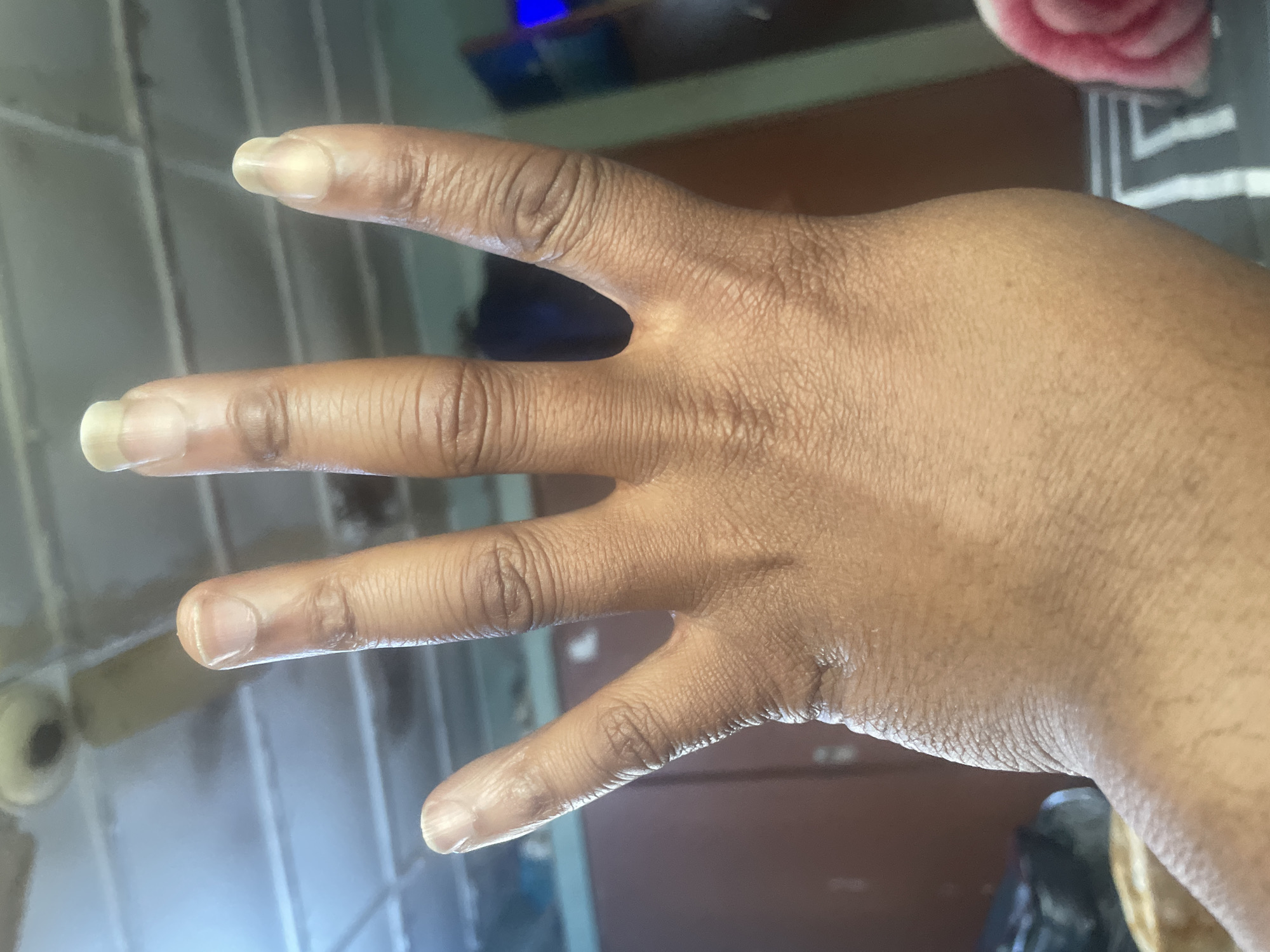 An overhead view of a dark-skinned person's left hand is presented. The hand is open, with fingers extended upwards and spread apart. The fingernails appear unpolished and slightly long. The background is blurred, but a ceiling fan and a white-tiled ceiling are visible above the hand. The lower portion of the image shows a part of what appears to be a bed or sofa with a patterned throw. The lighting is bright, suggesting an indoor environment. There are no visible indications that this image was taken in Jos, Nigeria.