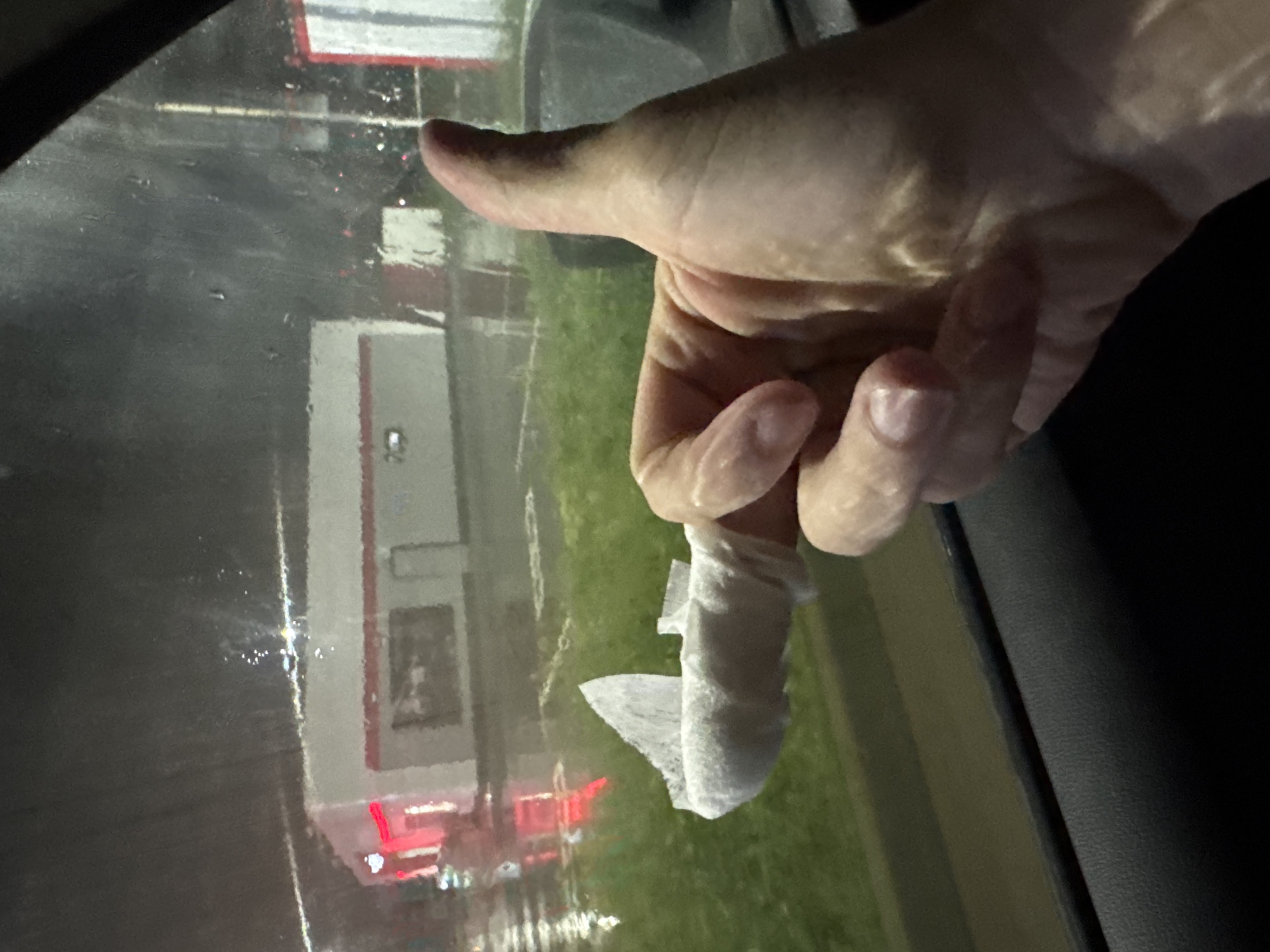 The image depicts a hand with a bandaged finger positioned in front of a car window. Rain droplets are visible on the window's surface. Through the window, a building with red and white accents is reflected. The environment outside the window appears to be grassy. There is no information to confirm the location is Krasnodar, Russia.