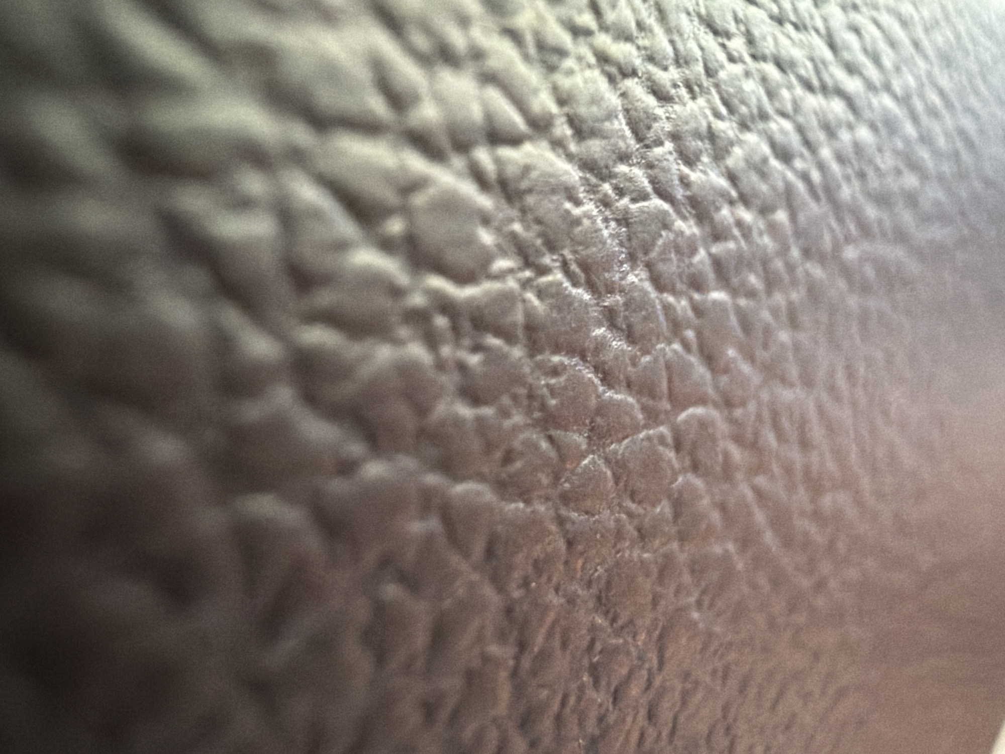 The image is a close-up, low-angle macro photograph of a textured surface that appears to be the skin of a person's arm. The skin has a matte, slightly dull finish and is characterized by visible pores and a natural, uneven texture. The lighting suggests it is an indoor environment, possibly a home, with soft illumination highlighting the contours and subtle variations in the skin's surface. There are no other discernible objects or individuals in the frame, focusing solely on the detailed texture of the skin. The location within Southlake, United States of America, is not identifiable from the visual information provided in the image.