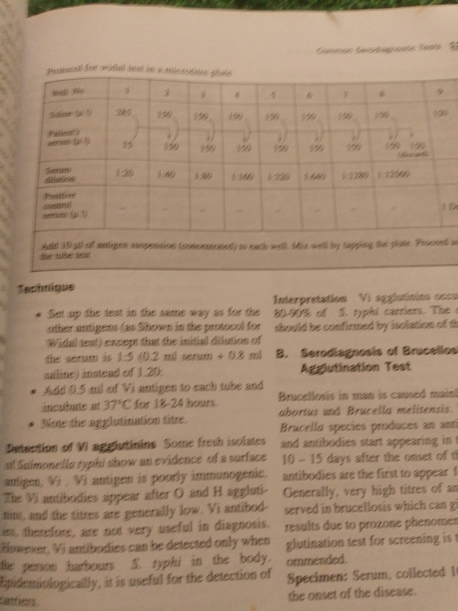 This media file contains a close-up shot of an open book. The book features a page with text and a table, suggesting a scientific or medical context. The text appears to be a protocol or a description of diagnostic tests, likely related to microbiology or serology. There is a section titled "Technique" and another labeled "Interpretation," along with a subsection "Serodiagnosis of Brucellosis Agglutination Test." The table provides details for a "Protocol for widal test in a microtitre plate," with columns indicating different well numbers and rows for saline, patient's serum, and serum dilution.
Visible text includes terms like "Saline (µl)," "Patient's serum (µl)," "Serum dilution," "Positive control serum (µl)," "Technique," "Interpretation," "Vi agglutinins," "Serodiagnosis of Brucellosis Agglutination Test," and "Brucellosis." The image quality is moderate, with some blurriness. There are no discernible people, objects, specific scene elements, time of day, weather cues, or emotions, as the focus is solely on the printed content of the book. The context of "Jalingo, Nigeria" does not appear to be directly evident from the image itself, but it might be associated with the source of the image or the subject matter being studied.