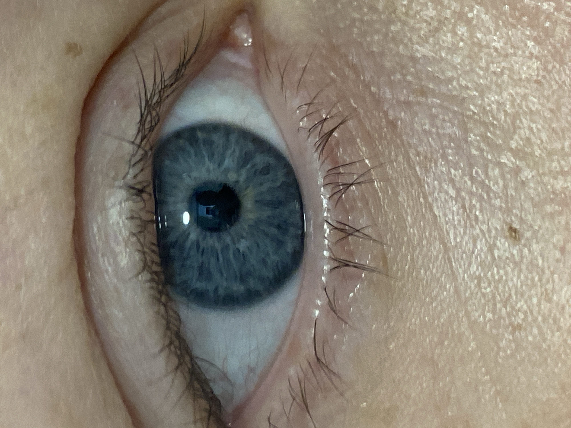 A close-up image showcases a human eye, featuring a blue iris with intricate patterns and a dark pupil reflecting light. Eyelashes frame the eye, and the surrounding skin exhibits fine textures and a small mole. The image lacks contextual information to determine a location or specify any actions or interactions. The setting appears to be a studio or controlled environment, considering the high level of detail captured. There is no information to confirm that it is located in Sochi, Russia.