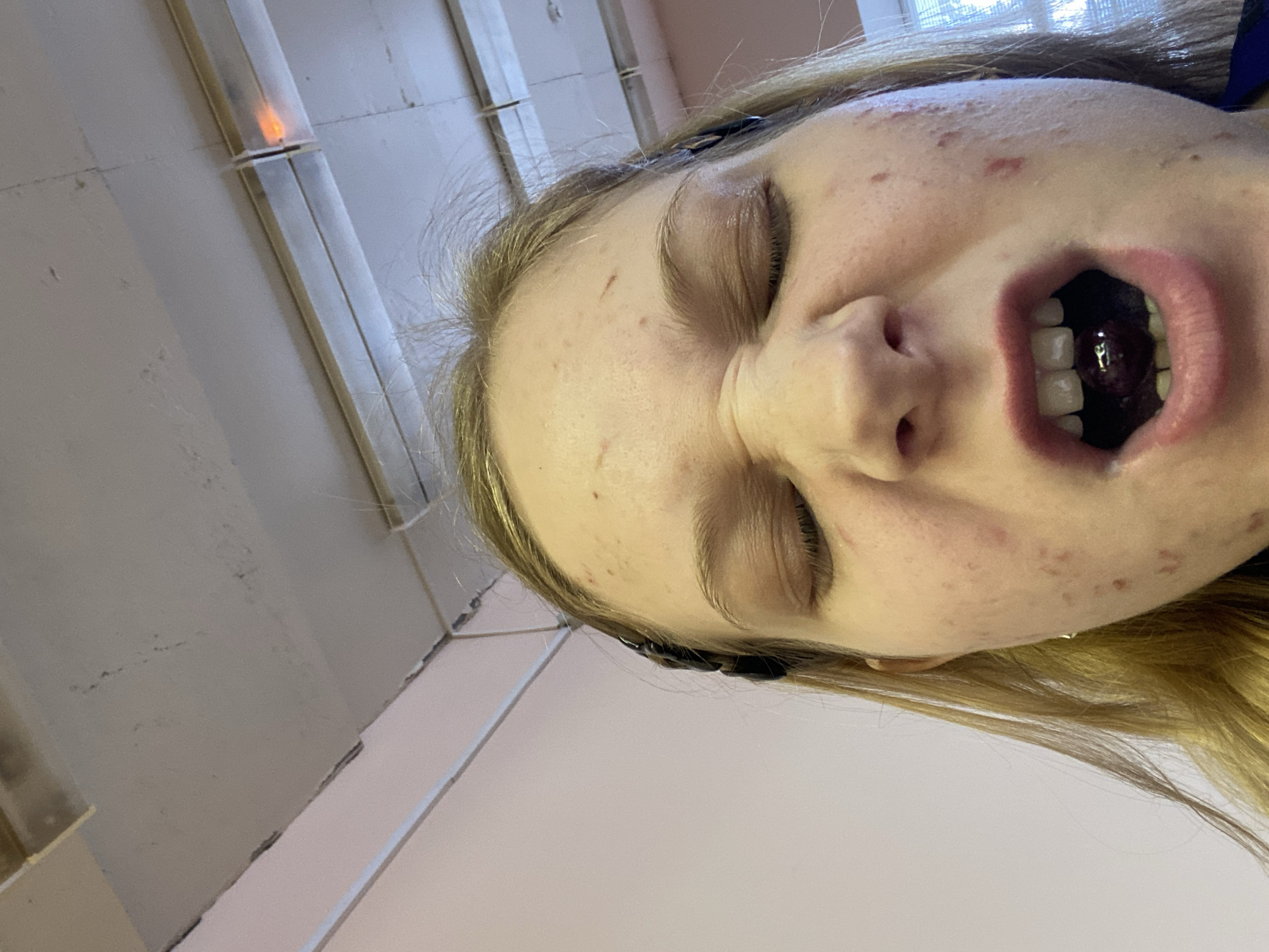 A close-up, low-angle shot shows a fair-skinned individual with blonde hair, eyes closed, and mouth open, revealing a darkened interior with visible teeth. The person's face displays skin blemishes and a slight grimace. The background consists of a ceiling with fluorescent lighting and a wall, both appearing worn. The location is Unknown, Unknown.