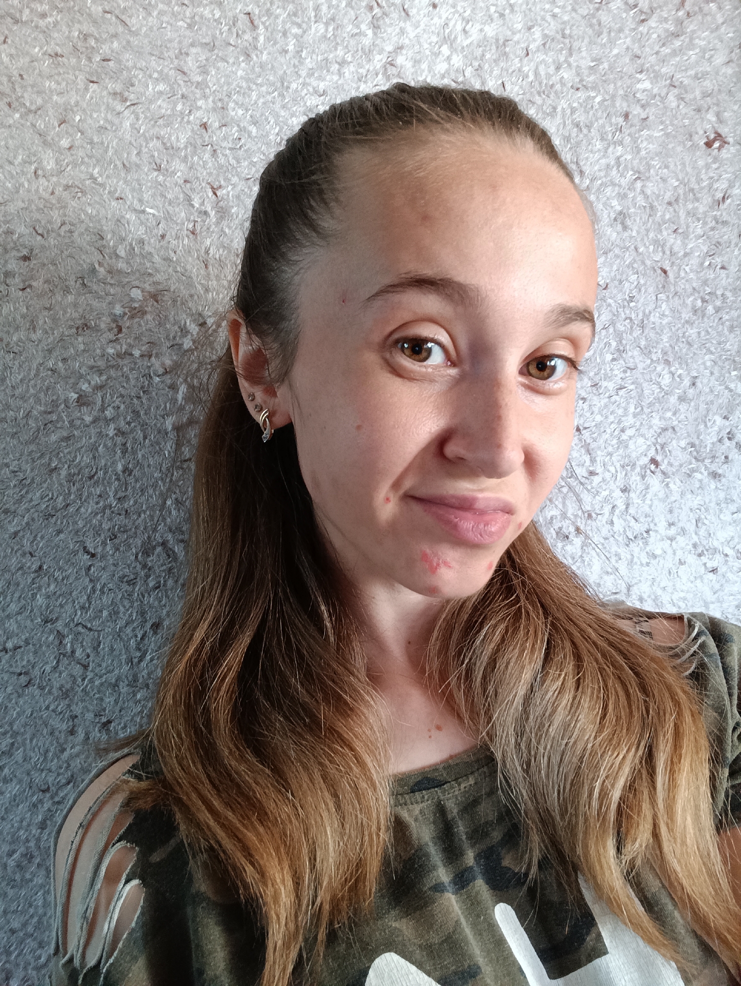 In this medium shot, a young woman with long, light brown hair pulled back in a ponytail is pictured against a textured gray background. She is looking directly at the camera with a slight smirk. Her makeup is minimal, with a few red blemishes visible on her chin and jawline. She is wearing a camouflage t-shirt with ripped shoulders. The overall lighting is bright, suggesting an indoor setting with natural light. The image was taken in Vypasne, Ukraine.