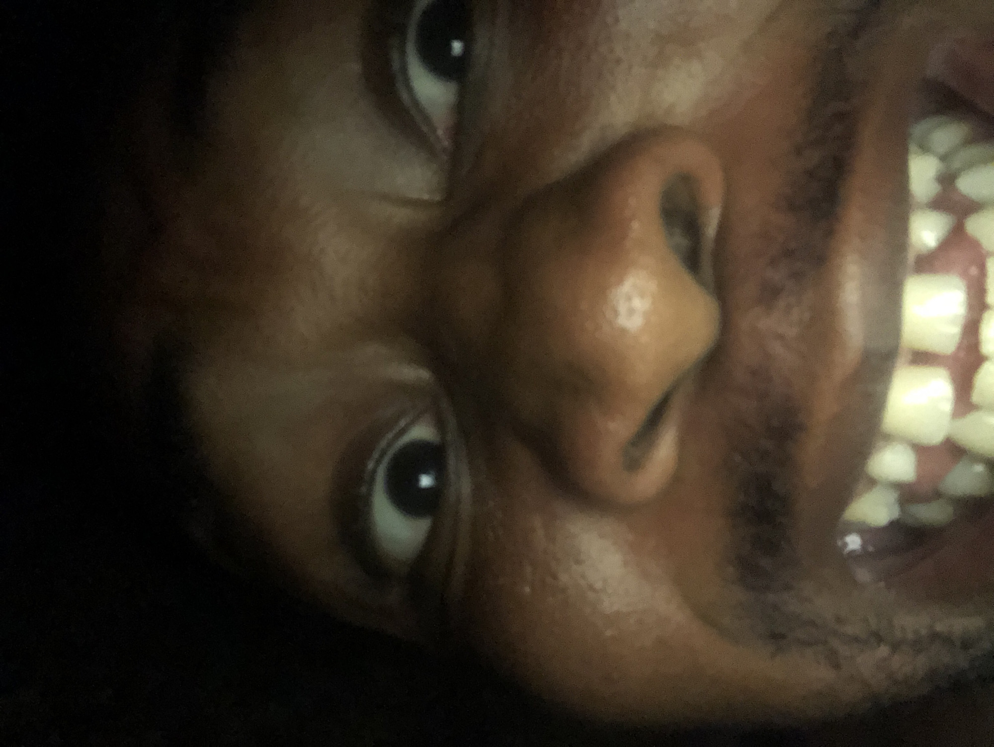 A close-up, rotated view of a person's face fills the frame. The person has dark skin, and the focus is on their features: eyes, nose, and mouth. The eyes are wide open, and a full set of teeth is visible. The background is out of focus and dark. The location is Unknown, Unknown.