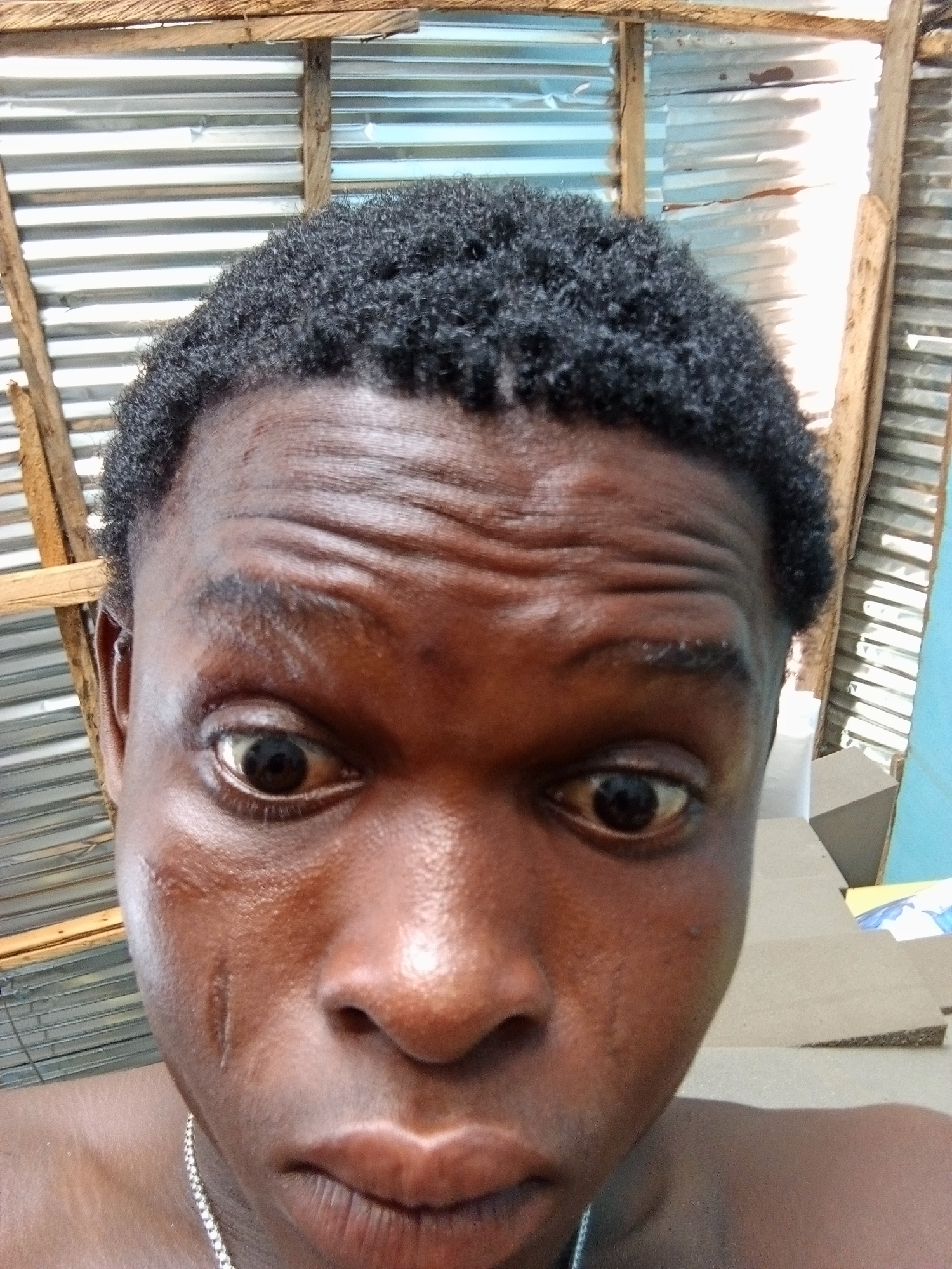 A close-up selfie shows a person, likely male, with dark skin and short, tightly curled dark hair, looking directly into the camera. The person's eyes are wide open, giving an intense or surprised expression, and their forehead is wrinkled. Visible marks or scars are present on their left cheek, and their skin appears shiny. A silver-colored chain necklace is worn around their neck.
The background reveals a setting constructed with corrugated metal sheets, which appear to form a wall or ceiling, supported by unrefined wooden beams. Bright natural light illuminates the corrugated metal from the right side of the frame, suggesting it is daytime. In the lower right background, there are cardboard boxes and a piece of light blue material, indicating a functional or possibly makeshift interior space, consistent with a setting in Ado, Nigeria. No text is visible in the image.