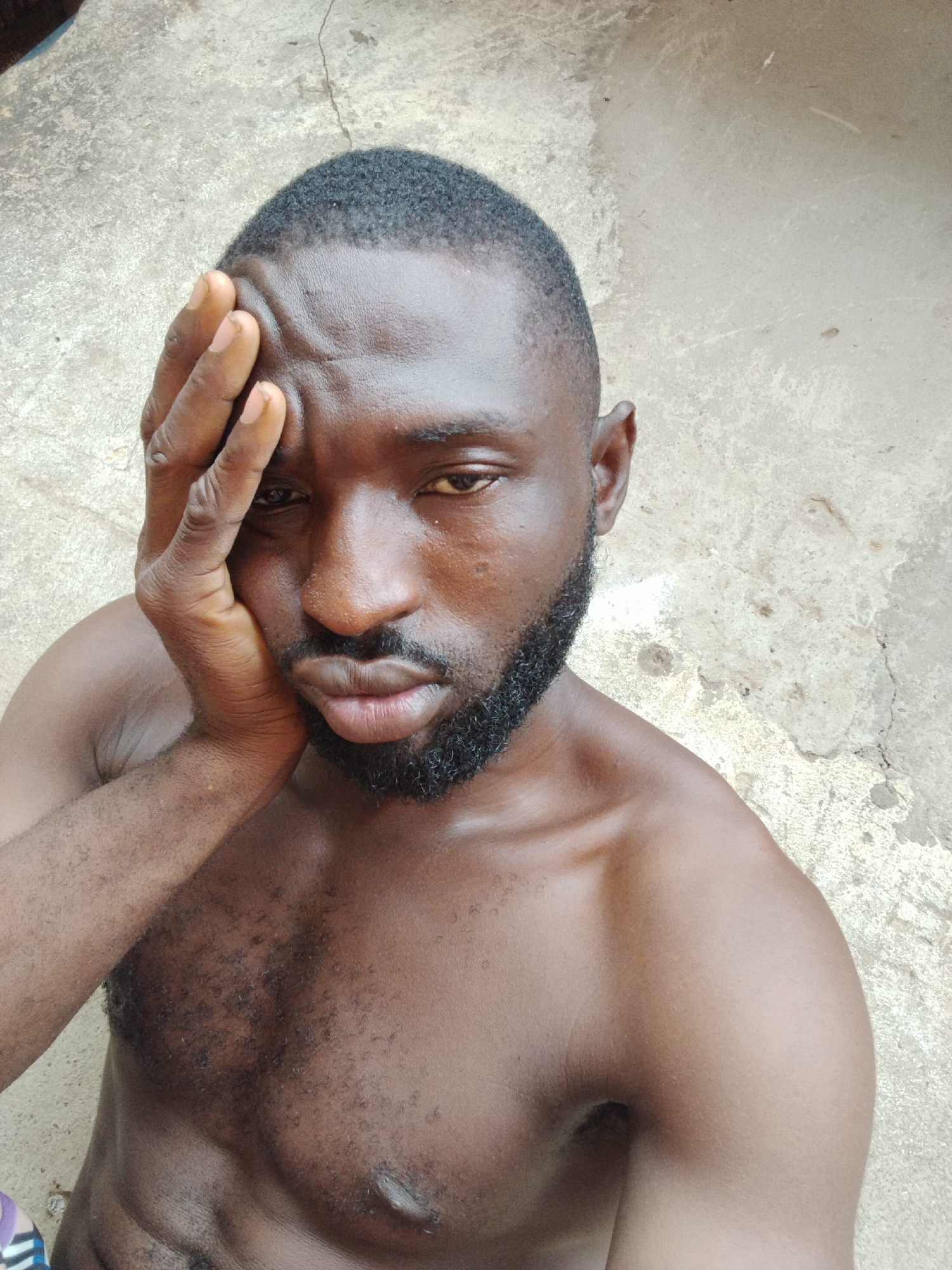 A close-up portrait features a Black man with a medium-dark skin tone, short black hair, and a full, dark beard. He is bare-chested. His left hand is raised to the side of his face, with fingers splayed, resting against his temple and cheek. The man has a pensive or serious expression, with slightly puffed lips, and looks directly into the camera. The background consists of a light-colored, textured concrete or stucco surface, showing various cracks and subtle discolorations. This suggests an outdoor or unadorned indoor setting. The lighting indicates it is daytime. No text is visible in the image. The scene is set in Sabon Tasha, Nigeria.