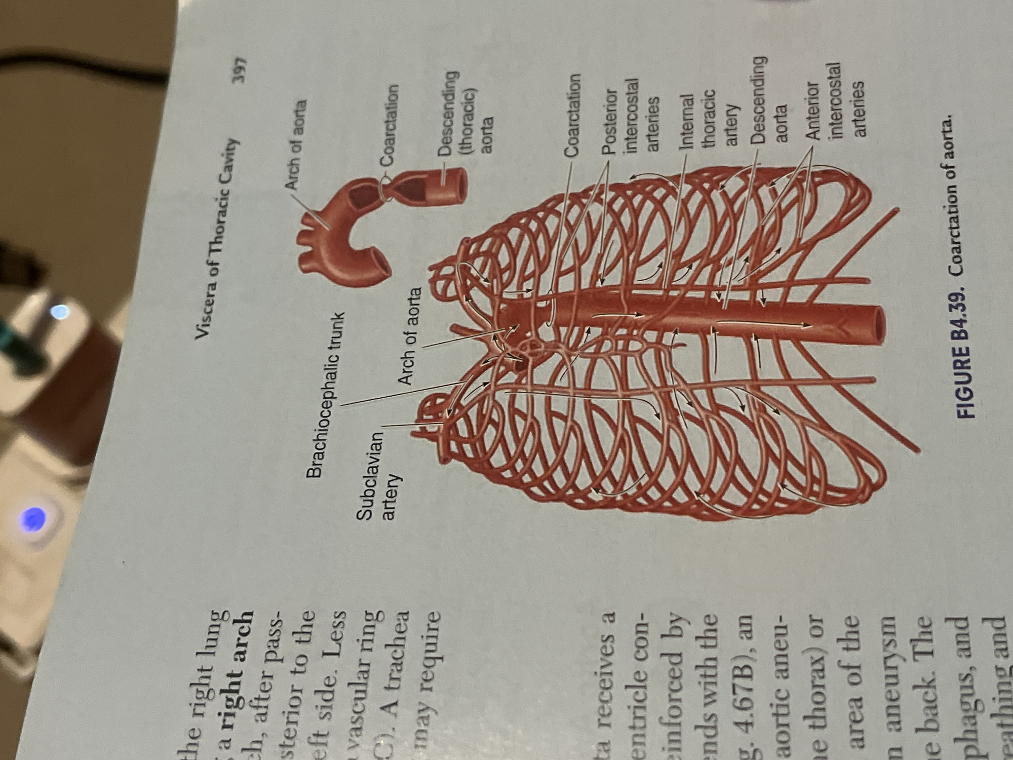 The image displays a medical illustration of the aorta and associated arteries within the thoracic cavity. It depicts the arch of the aorta, the descending thoracic aorta, the brachiocephalic trunk, the subclavian artery, intercostal arteries, and the internal thoracic artery. The illustration also highlights areas labeled "Coarctation," indicating a narrowing of the aorta. The text beside the illustration discusses the right lung, vascular rings, and trachea. The image is labeled "FIGURE B4.39. Coarctation of aorta." The background shows a blurred office or home environment with a power strip and a blue light. There is no information in the image that relates to the city of Jalingo, Nigeria.