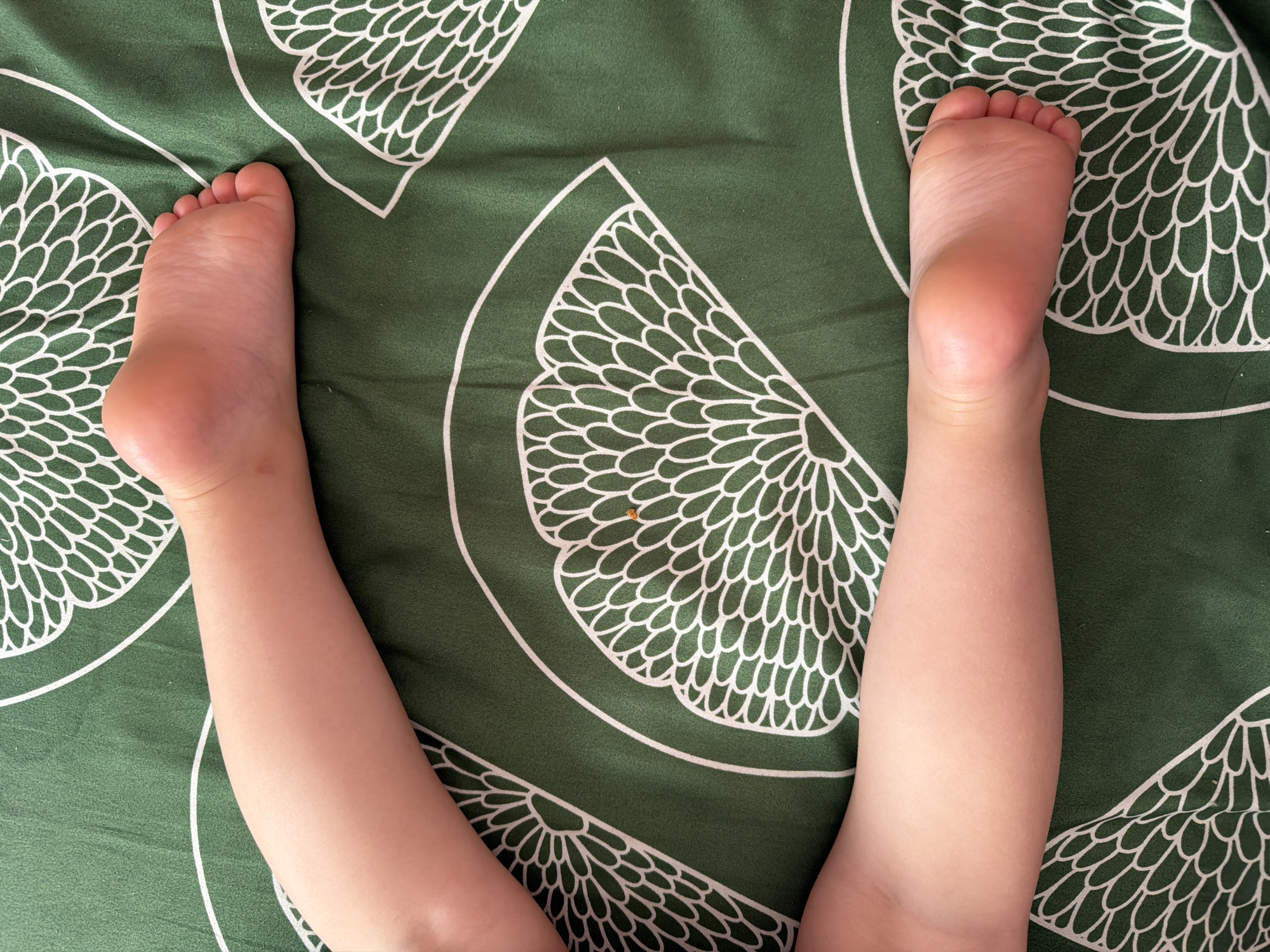 The image shows the lower legs and feet of a child lying on a green bedsheet with a white floral fan pattern. The child's skin is light-skinned. One foot is visible from the top, showing toes and the arch of the foot. The other foot is visible from the sole, showing the heel and the ball of the foot. The child's legs are bent. There is a small orange fleck on the bedsheet near the child's legs. The image is taken from a top-down perspective. There is no discernible information about the location in Lopatino, Russia.