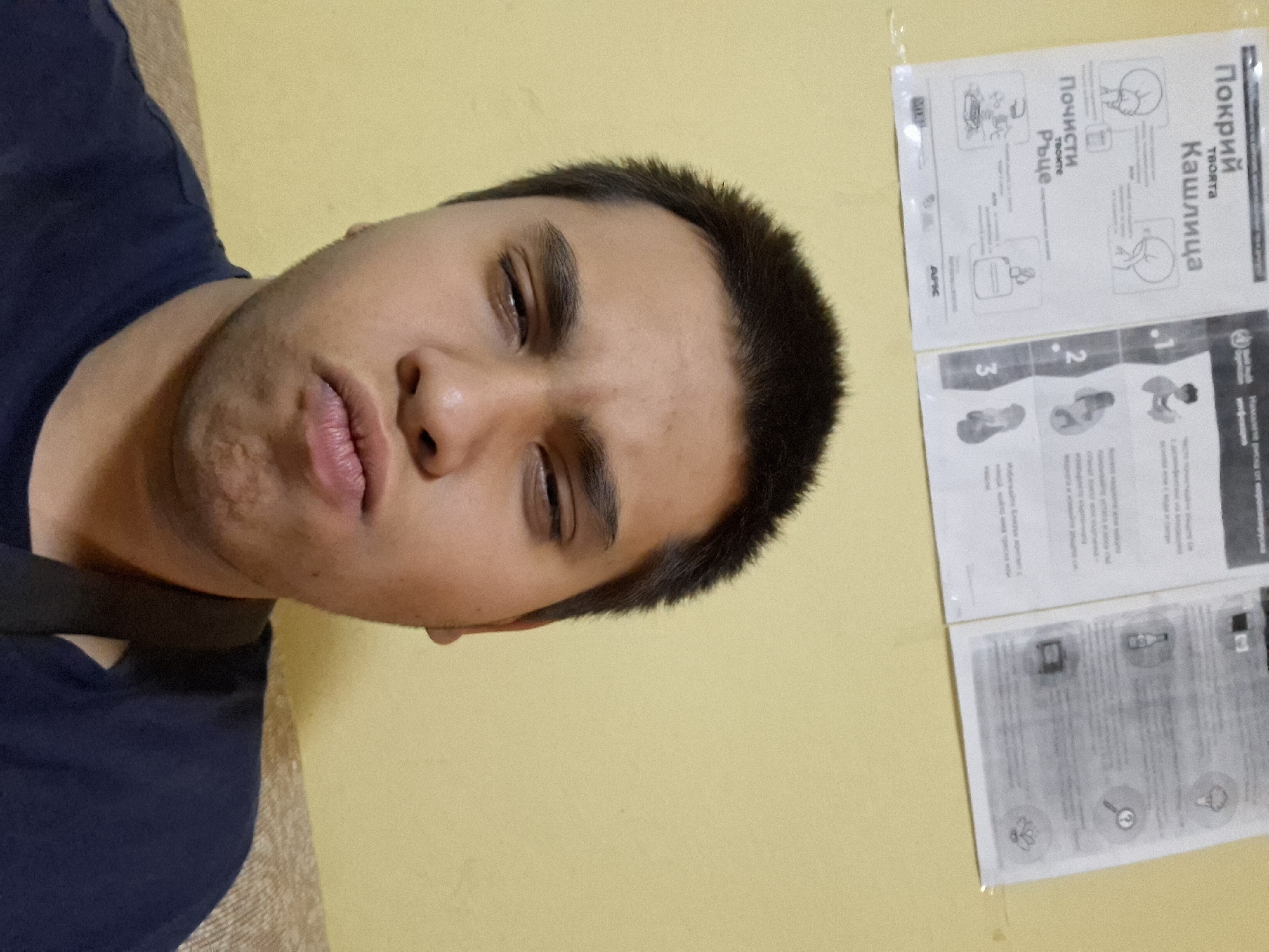 The image presents a close-up, slightly tilted view of a young person's face against a plain yellow wall. The individual, who appears to be male, has short dark hair and light stubble around the chin area. Their eyes are mostly closed, and their lips are slightly parted, giving the impression of drowsiness or deep relaxation. They are wearing a dark blue t-shirt, with a black strap visible over the shoulder.
On the yellow wall in the background, two paper documents are taped. These documents contain Cyrillic text and accompanying illustrations, resembling public health or informational posters. Visible text includes "Покрий твоята Кашлица" (Cover your Cough) and "Почисти твоите Ръце" (Clean your Hands), indicating advice on personal hygiene and disease prevention. Further text like "инфекция" (infection) and "който има треска или" (who has fever or) suggests guidelines related to health symptoms. Numbers 1, 2, and 3 are present with small diagrams, likely illustrating steps for handwashing or proper coughing etiquette. An acronym or logo, "APIC," is also visible. The scene is indoors, in what is contextually identified as Pleven, Bulgaria.