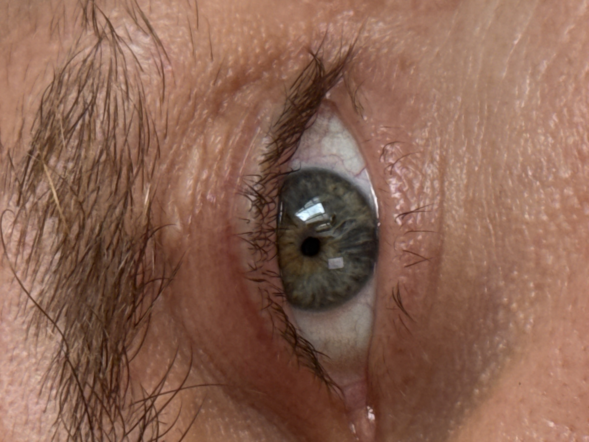 The image is an extreme close-up of a human eye, likely belonging to an adult. The eye has a green iris with darker speckling and a black pupil. The surrounding skin is light-skinned with visible pores and fine lines, particularly on the eyelid and forehead area above the eyebrow. The eyebrow is thick and dark brown, with individual hairs clearly visible. Eyelashes are dark and appear to be of average length. The whites of the eye show some visible blood vessels. The lighting in the image creates reflections on the surface of the eye, indicating a light source. There is no discernible urban or natural environment visible; the image is focused solely on the facial feature. The location in Da Lat, Vietnam, is not determinable from the provided image.