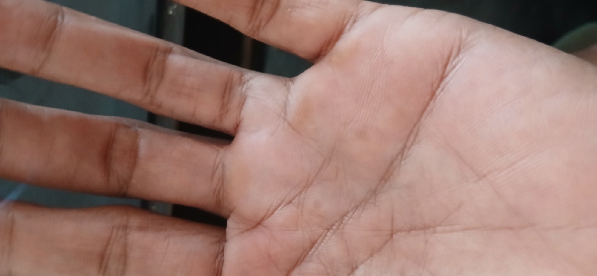 The image shows a close-up view of a human palm with visible lines and fingerprints. The skin tone appears to be light brown. The fingers are also visible, extending towards the top right of the frame. The background is dark and out of focus, suggesting an indoor setting. No specific location in Tenggarang, Indonesia can be identified from the image alone.