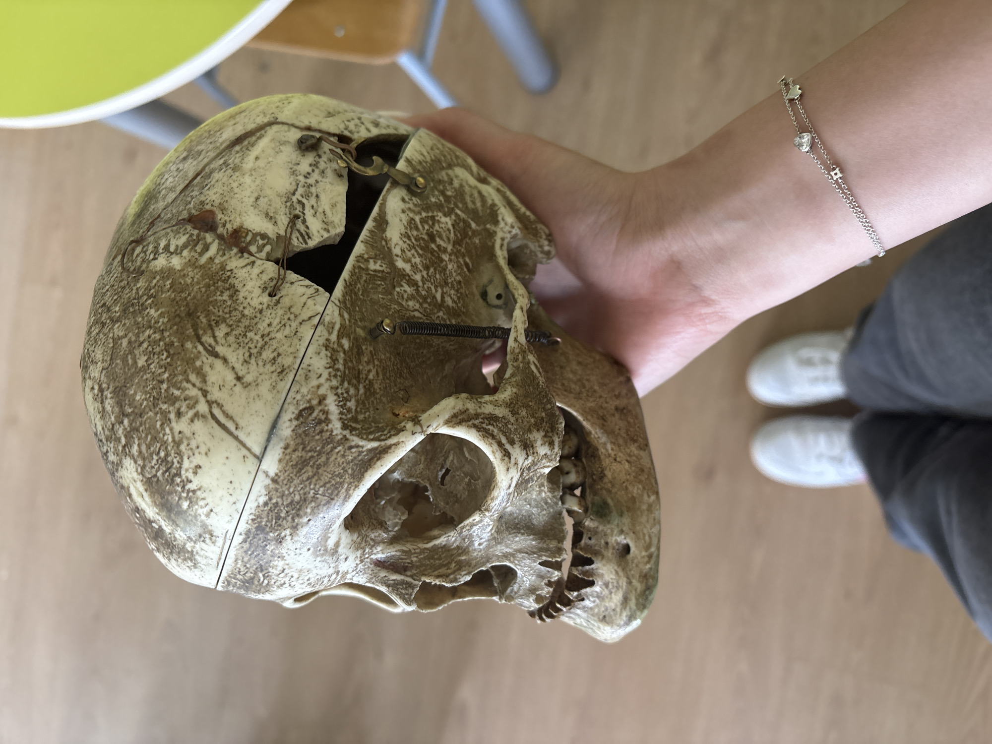 A person holds a disarticulated skull in their right hand. The skull is beige and brown, and appears to be a model. It is hinged at the top of the cranium. The person is wearing a silver bracelet with heart and diamond shapes. The person is also wearing dark gray pants and white shoes. A chair with a green seat and silver legs is visible in the background. The floor is light brown. The location is likely indoors, but there are no distinguishing features to indicate the city of Panagyurishte, Bulgaria.