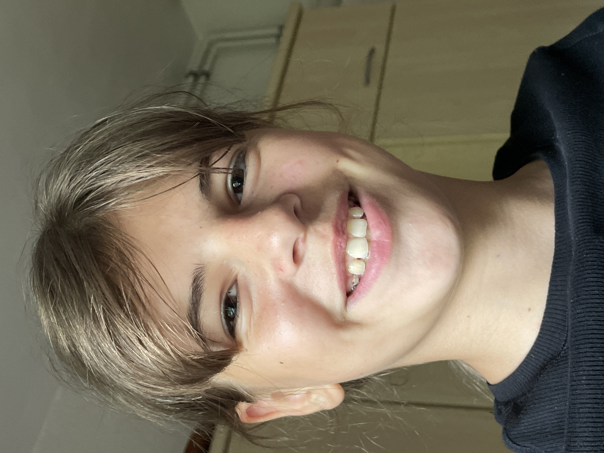 A close-up, eye-level, medium shot shows a smiling young girl with light brown hair and bangs. She is wearing a black t-shirt. Her teeth are slightly visible as she smiles, and she has braces. Her skin is light with some freckles and redness on her cheeks. The background appears to be indoors with wooden cabinets visible. The image does not contain any information that would allow for identification of the city of Kohden, Germany.